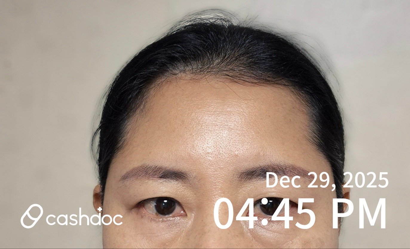 강남구 엔젤미의원, 친절하게 챙겨줘서 믿음 가는 눈썹 반영구 시술