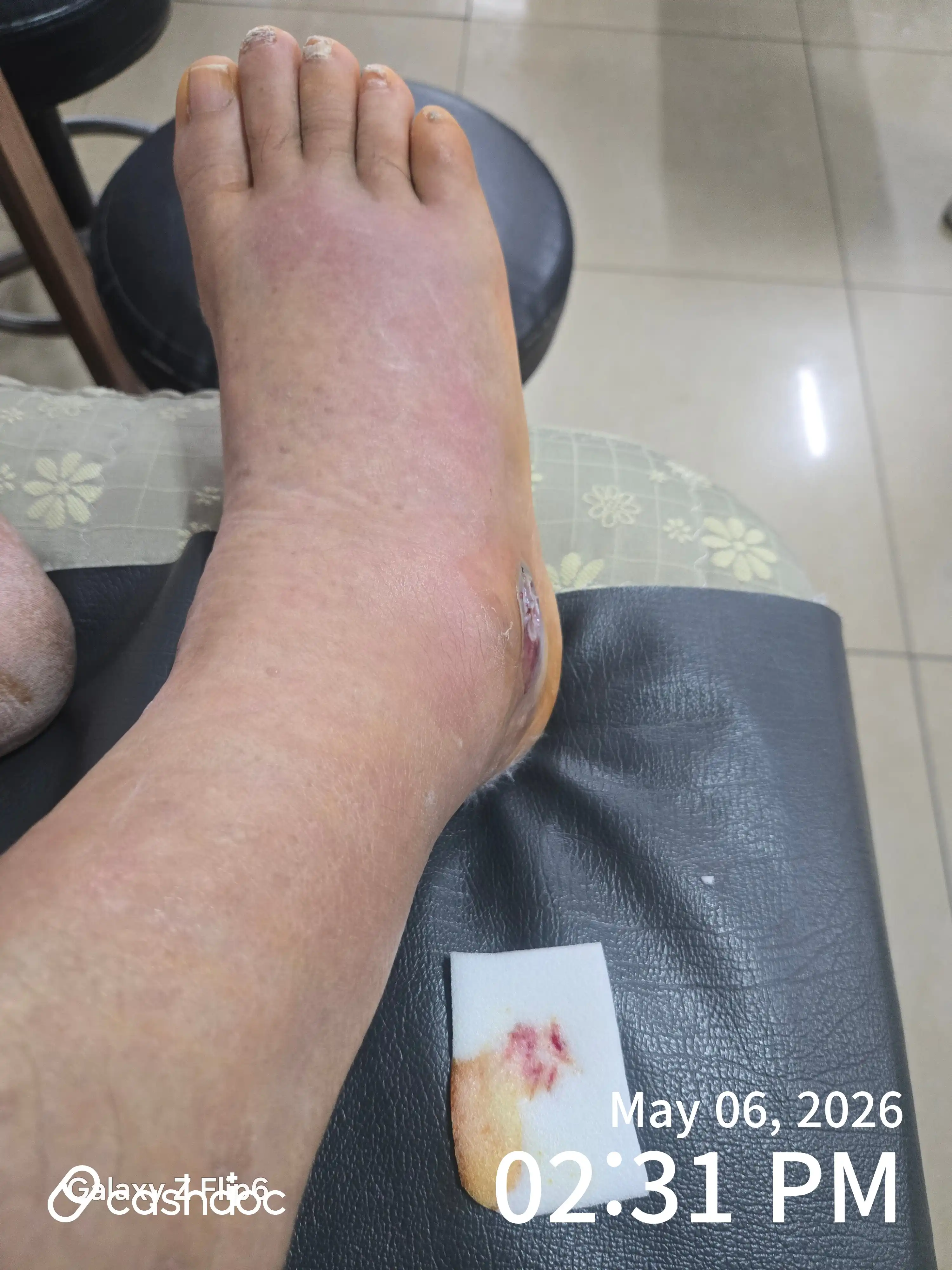Review photo