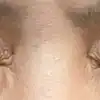 후