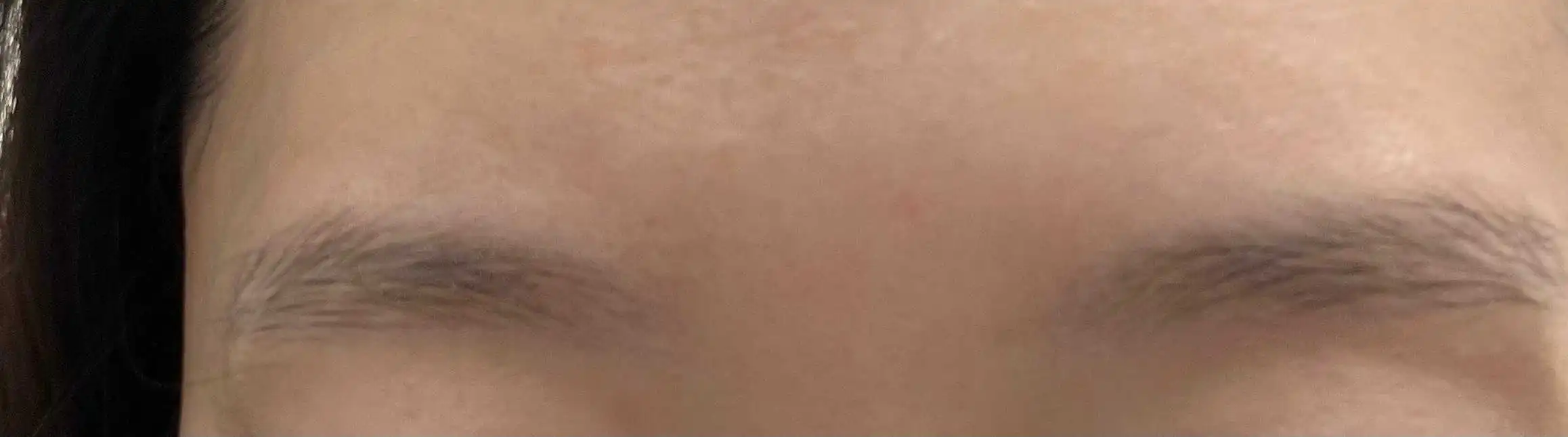 전
