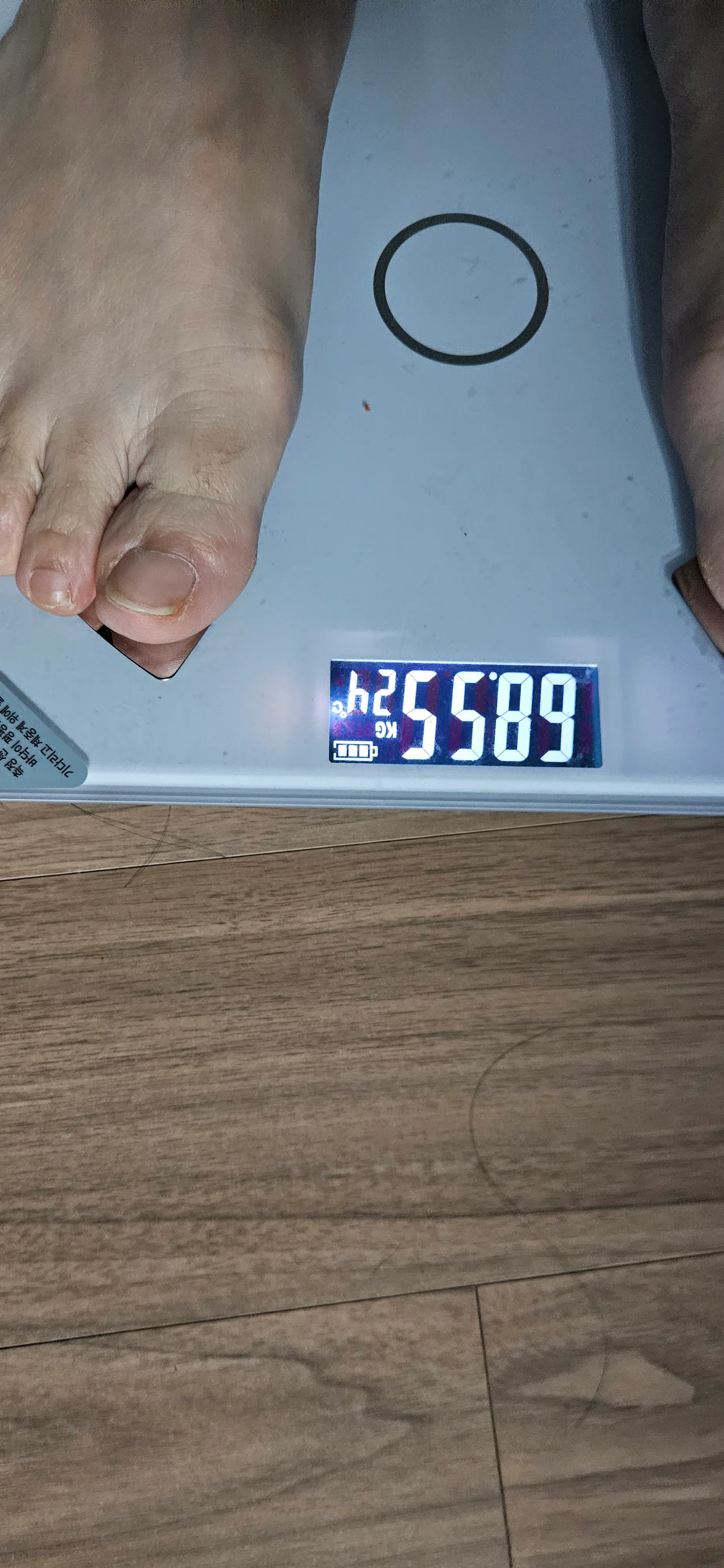 시술 전 — 자연과한의원 다이어트 지방사약 처방