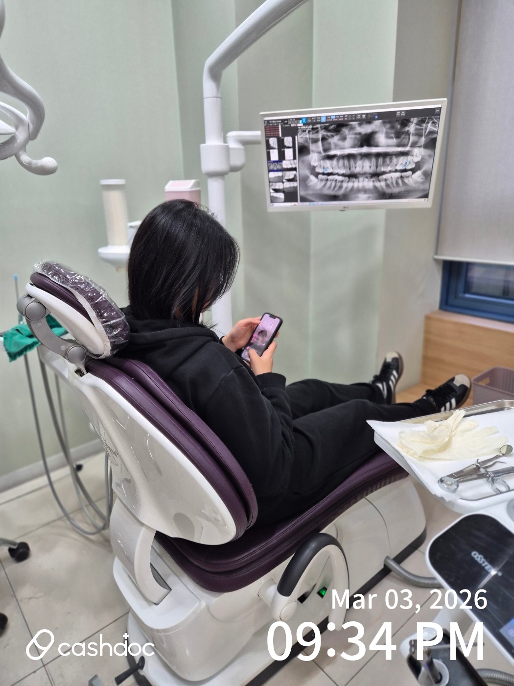 관악구 바른치과의원에서 아이 신경치료 후기