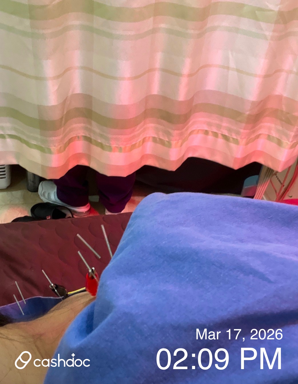 영등포 맑은숲한의원에서 목 뻐근함 침치료 후기