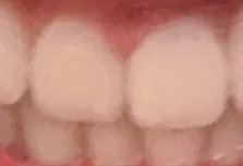 评价照片