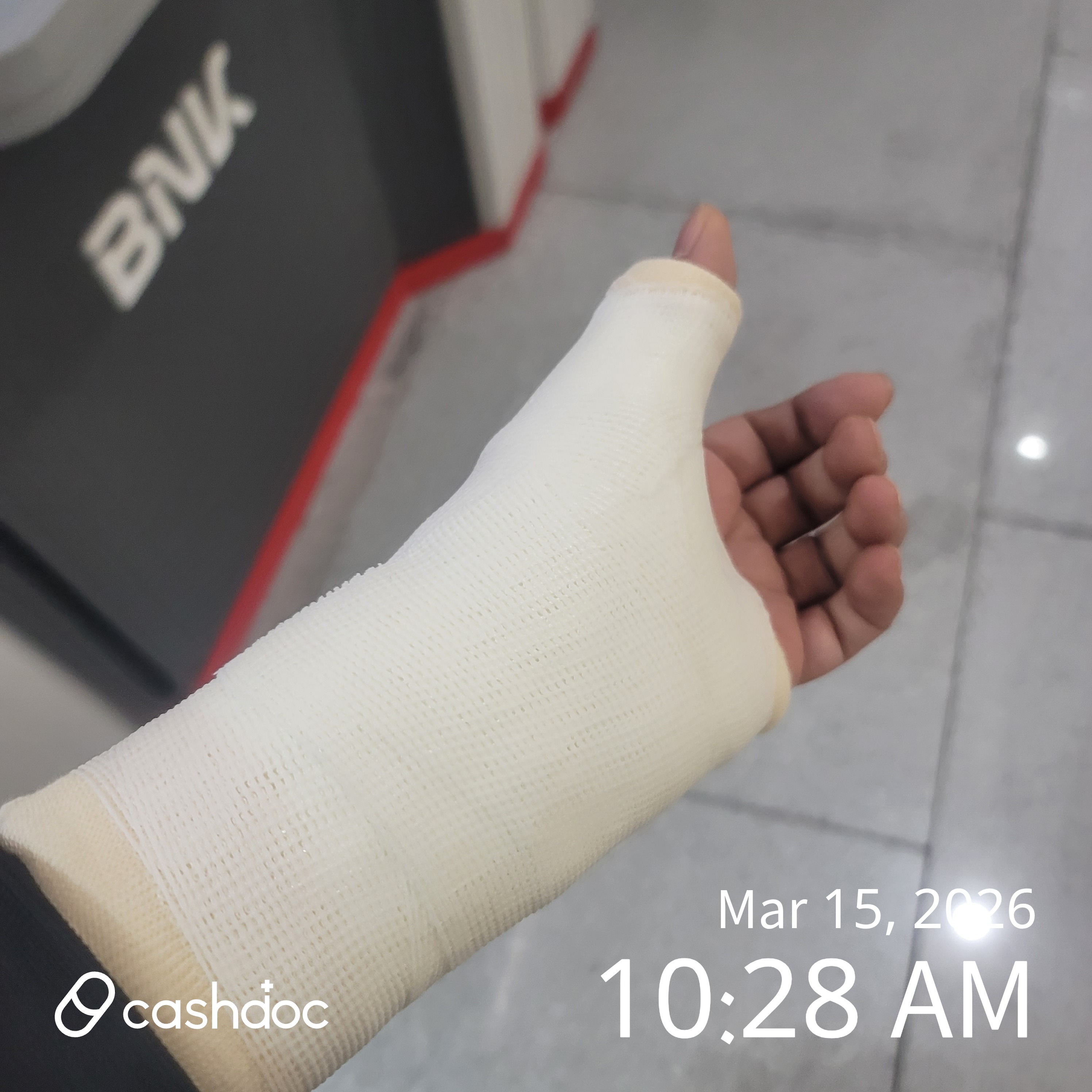 손목이 아파서 병원에 갔는데 x레이촬영결과 뭔가이상한점이 있다고 재촬영을하니깐 이거는ct찍고확인해야한다고하셔서 확인해본결과 수술을해야한다고해서 수술을한경험이있습니다. 제가아플때 조상일정형외과가면 진료도 잘보고 물리치료나 간호사분들도 친절히 잘대해주십니다.