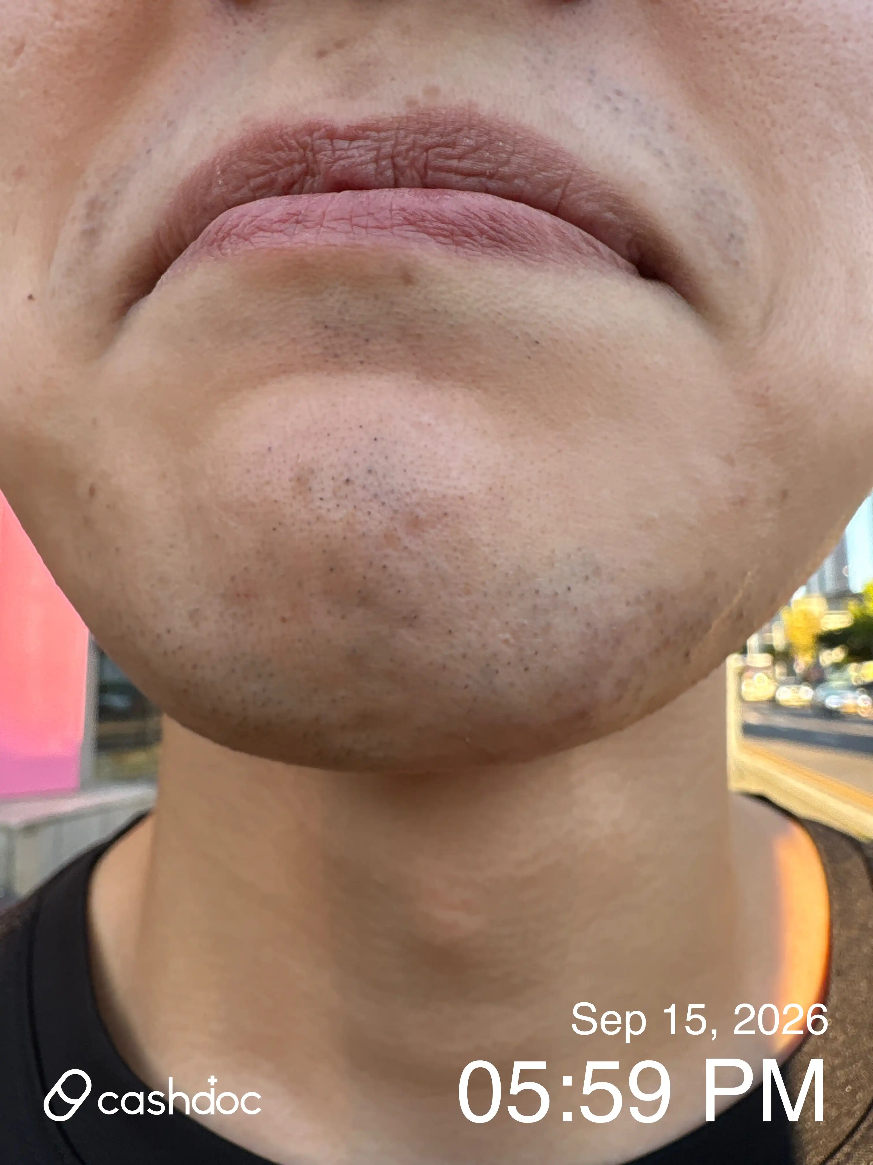 Review photo