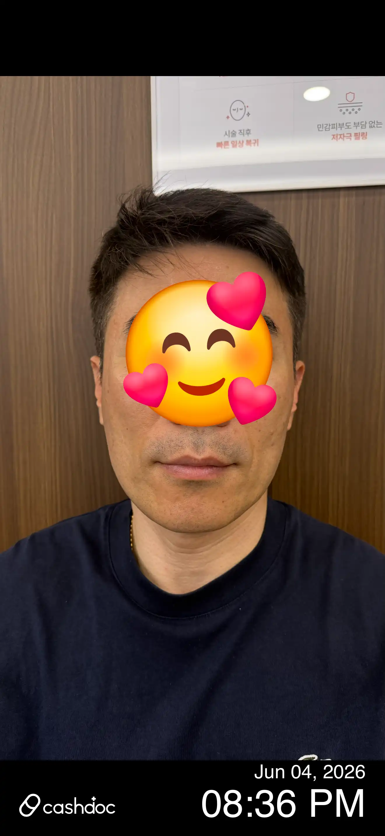 리뷰 사진