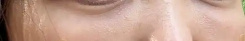 후