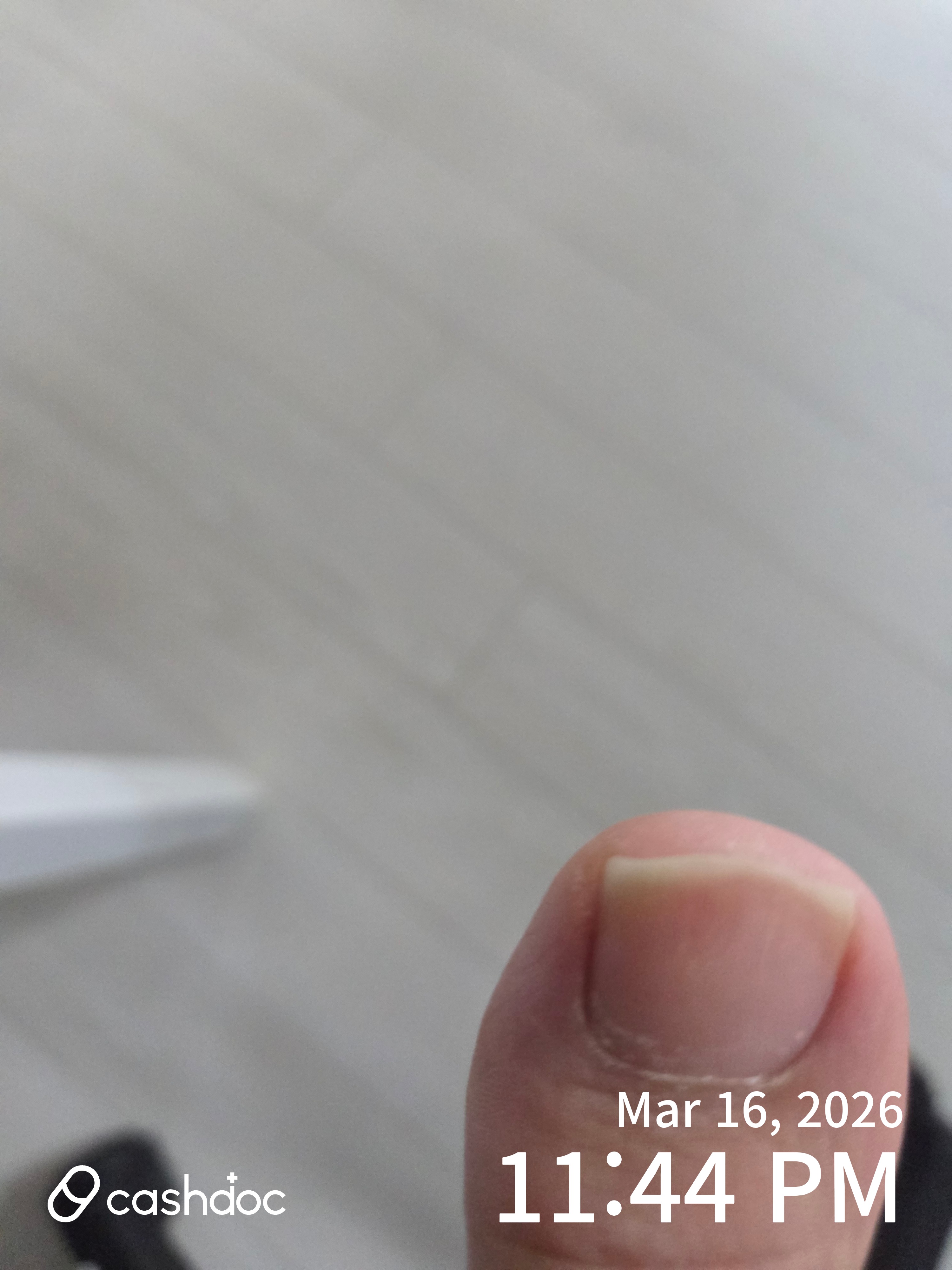 중구 충무로정형외과의원에서 발가락 진료 후기