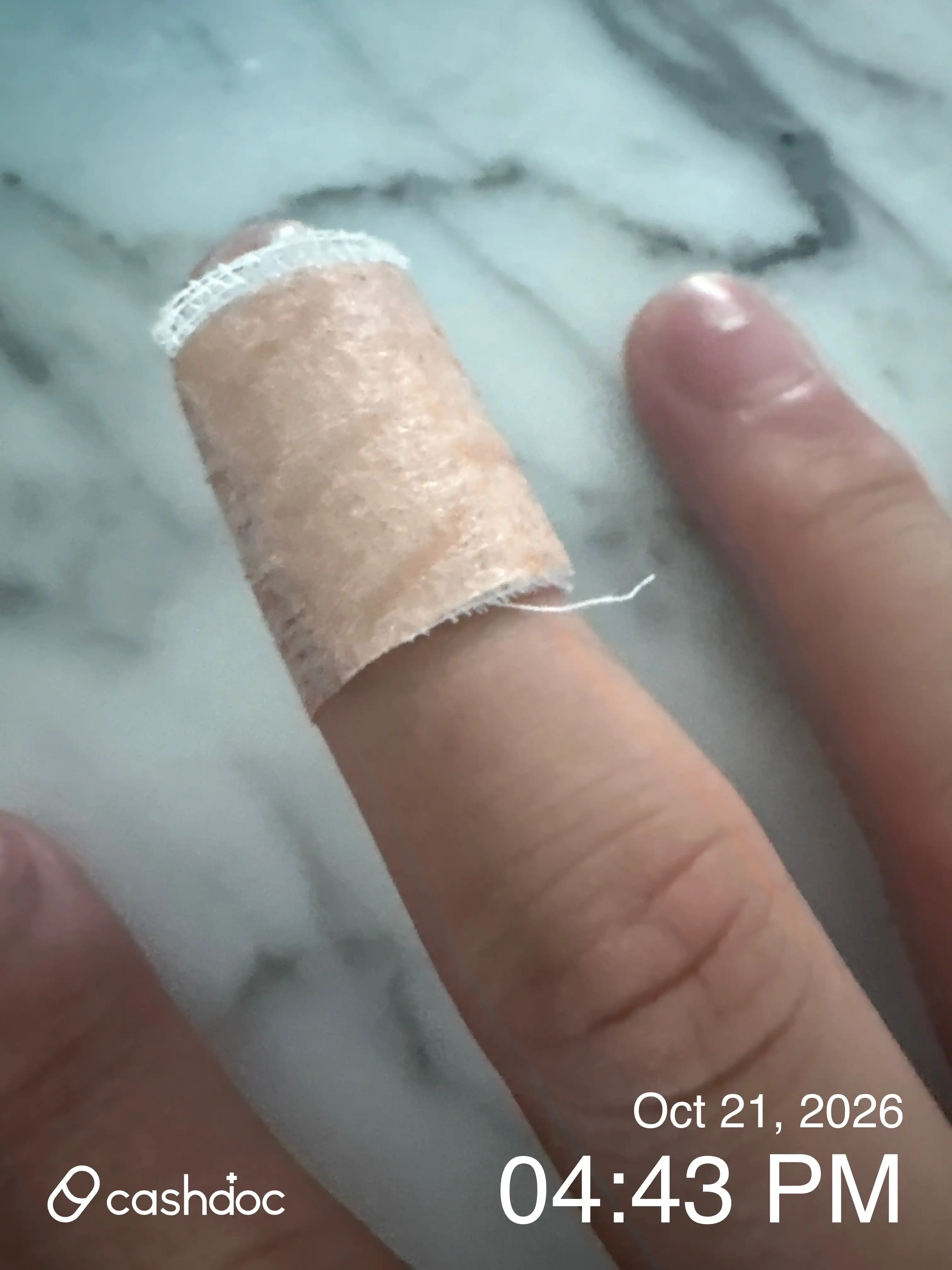마이클래식피부과의원 후기 사진