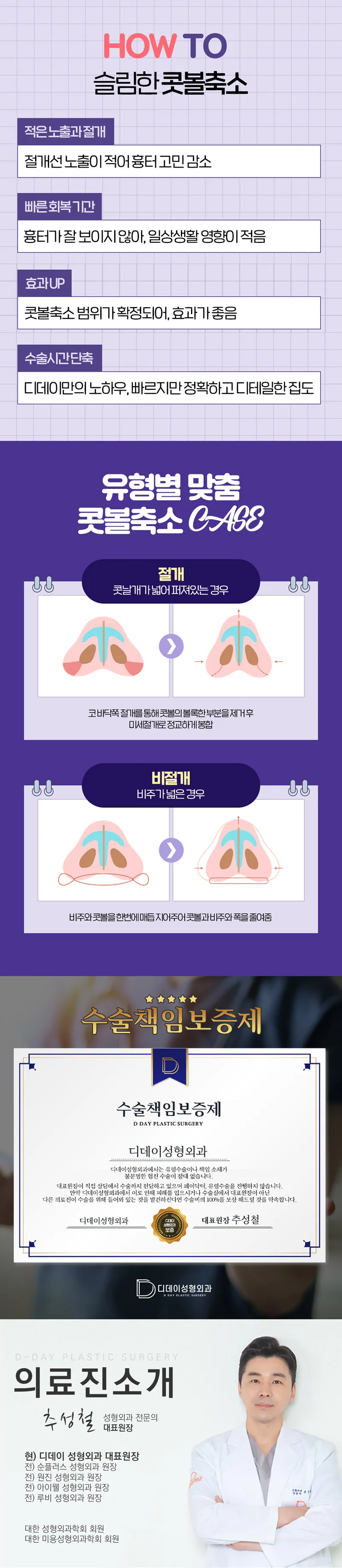디데이성형외과의원 디데이 슬림한 콧볼축소 55 이벤트, 시술 상세 이미지