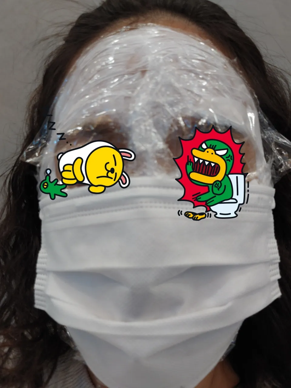 Before treatment — Pain reduction special #Rejuran Healer