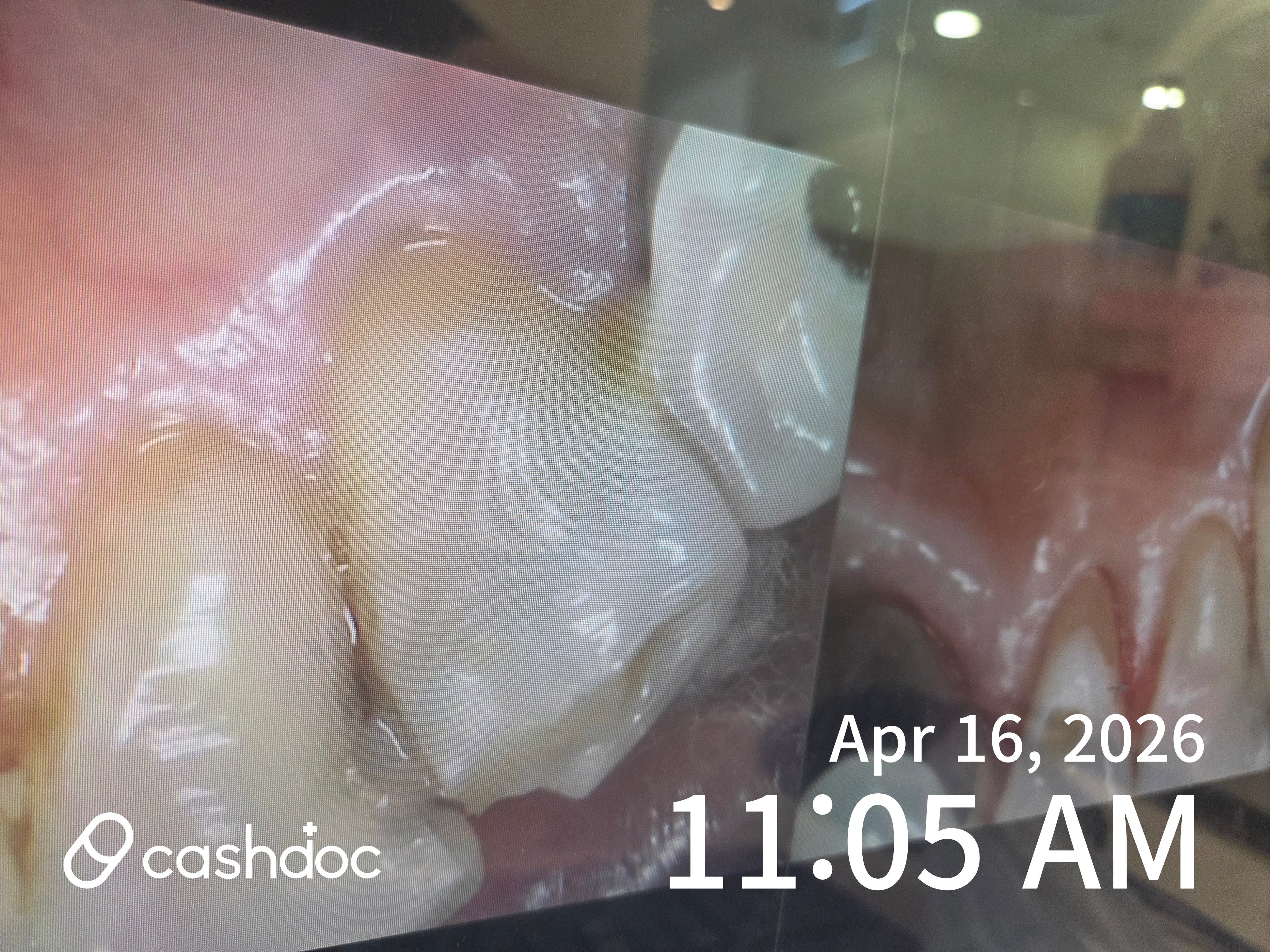 용인시 덴아트치과의원에서 공휴일도 진료 가능해 편리해요