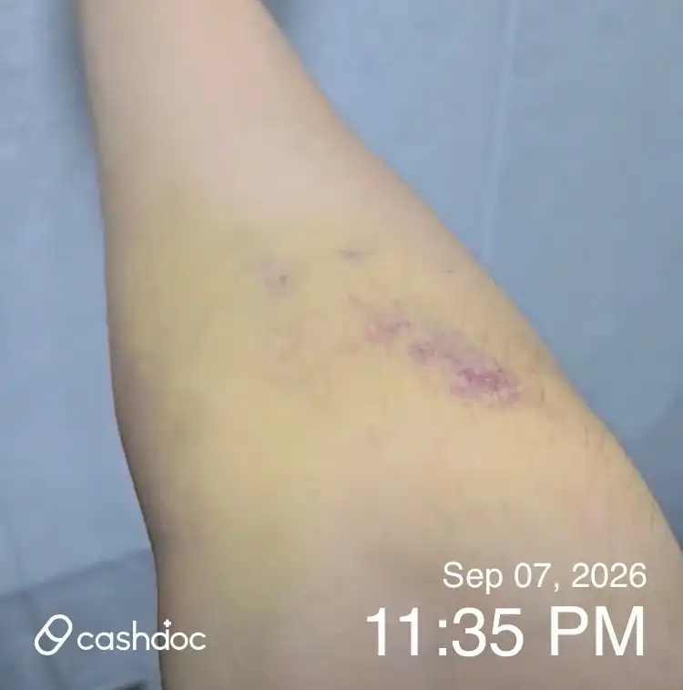 Review photo