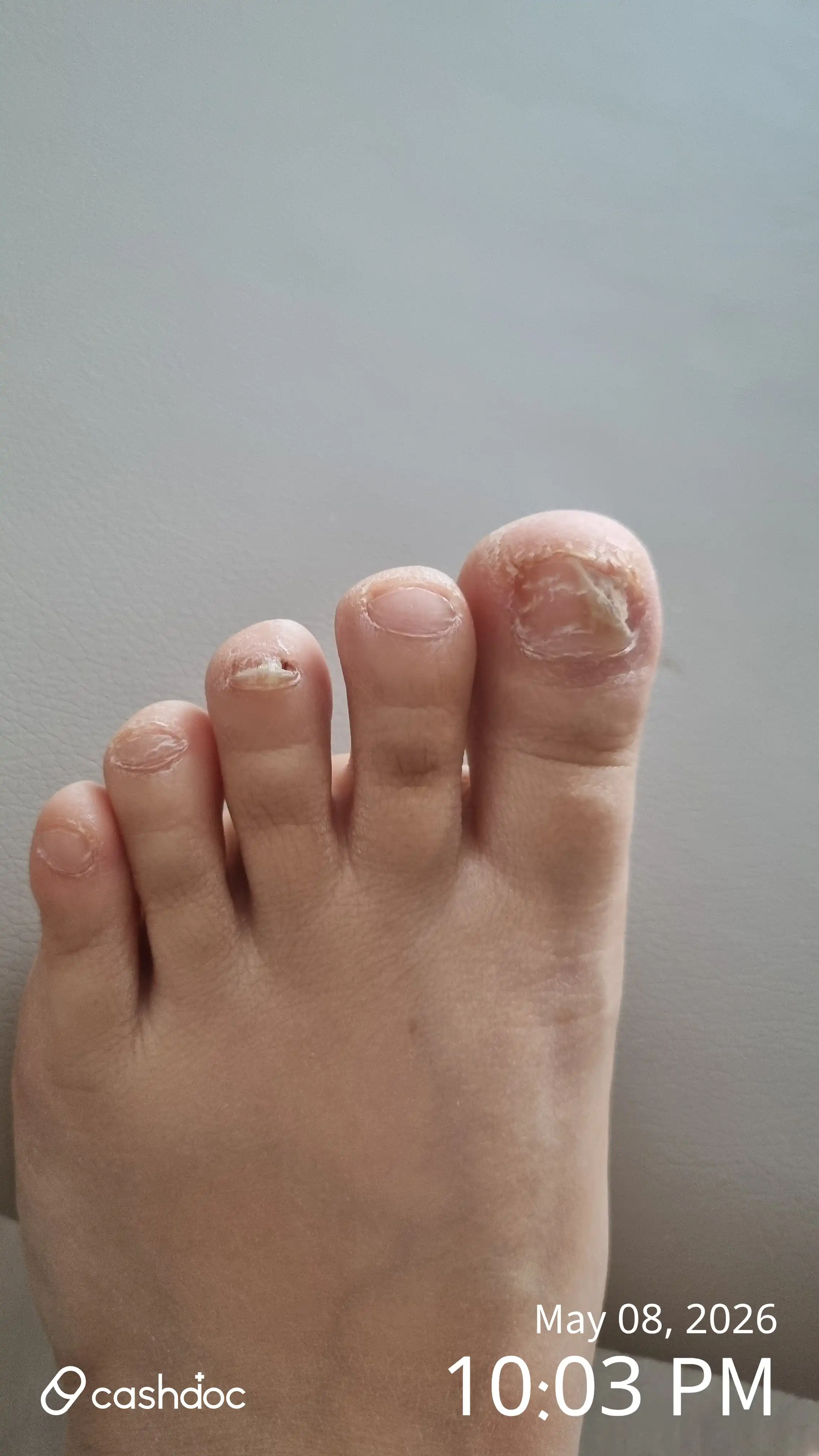 Review photo