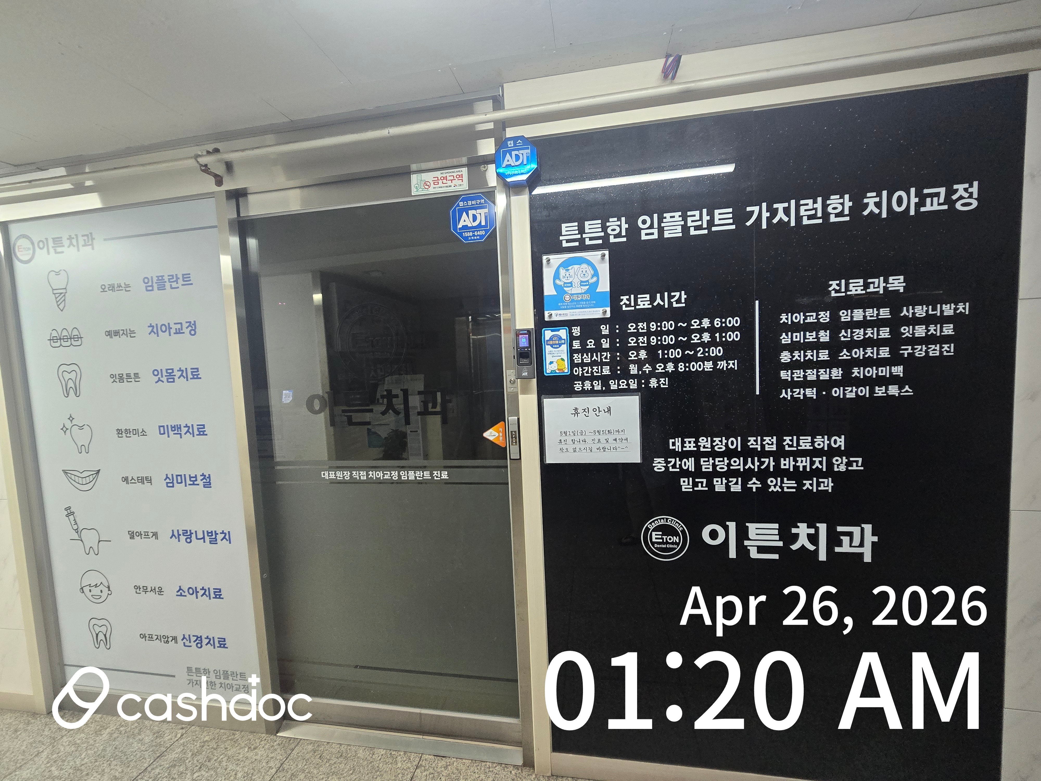 송파구 이튼치과의원에서 벌어진 앞니 레진으로 깔끔하게 해결!