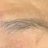 前
