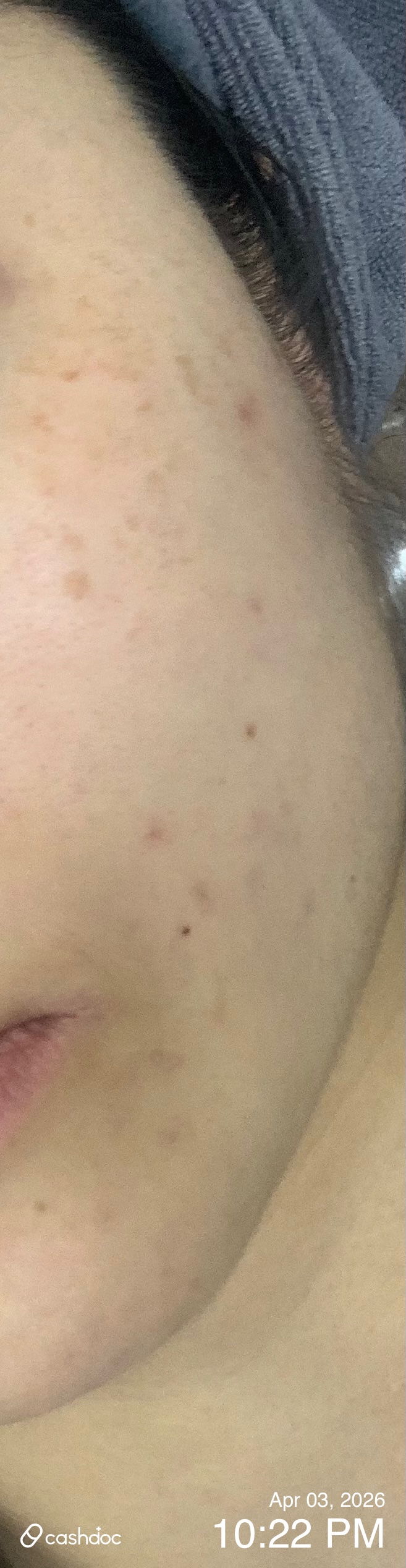 성남시 메이퓨어의원에서 저렴한 첫 방문 보톡스 경험!