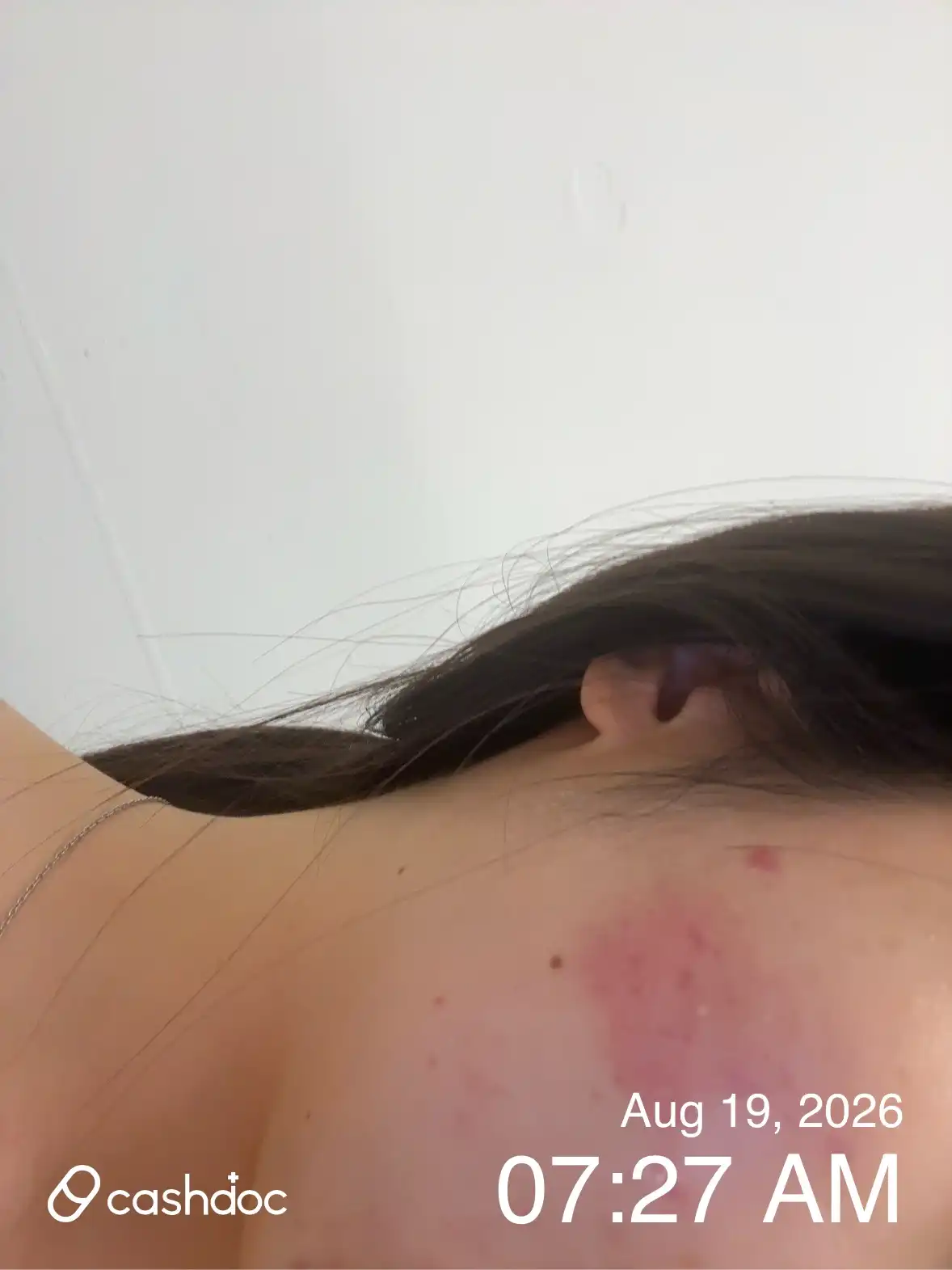 评价照片
