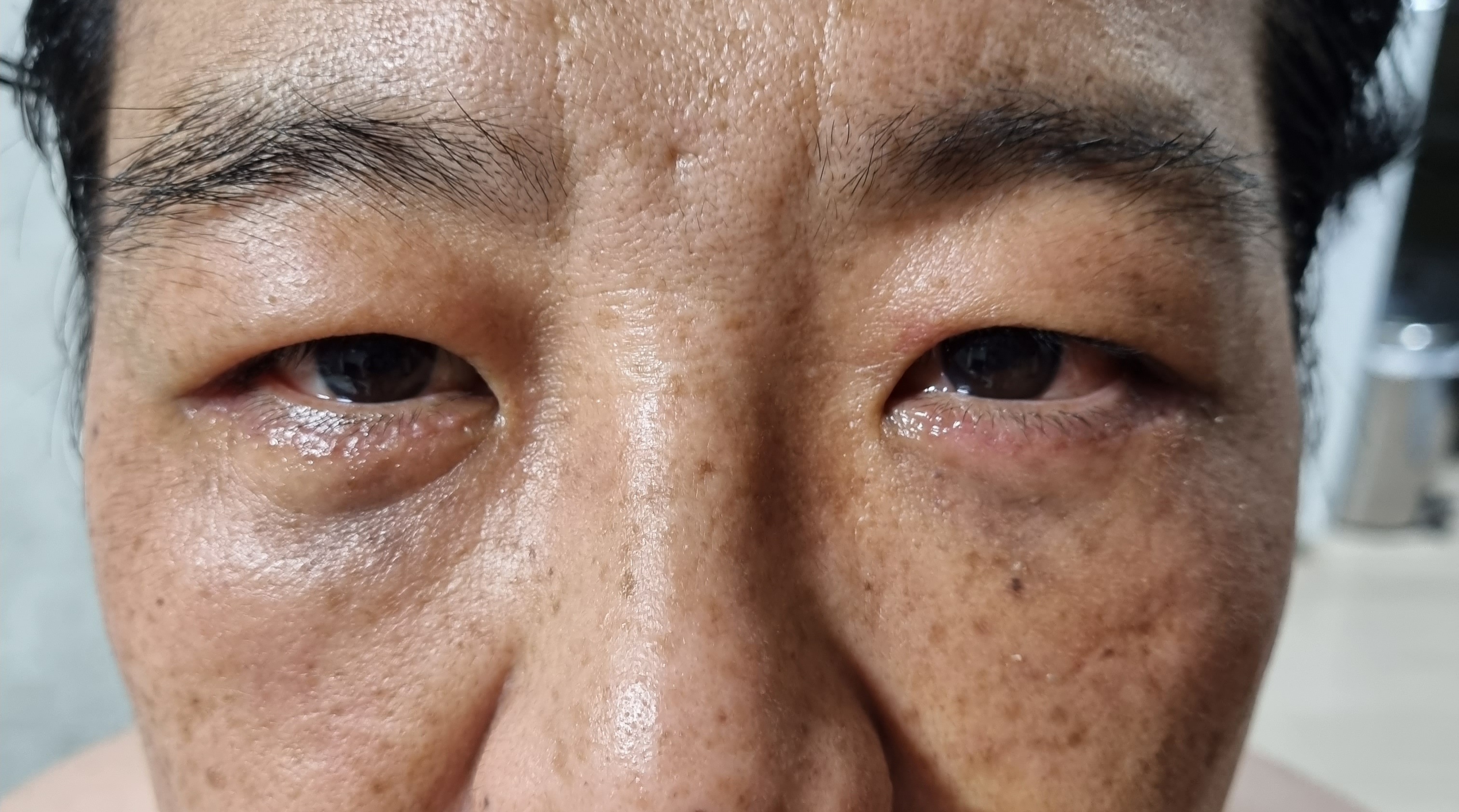 후