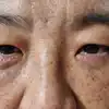 후