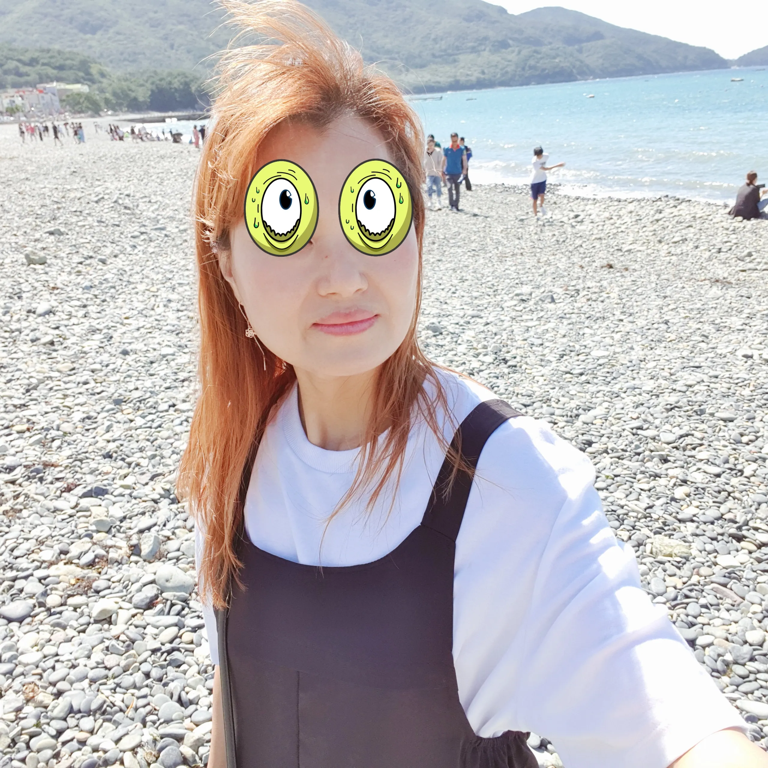 施術前 — ミケイ 自信のある鼻筋 ミント糸_ハイコ