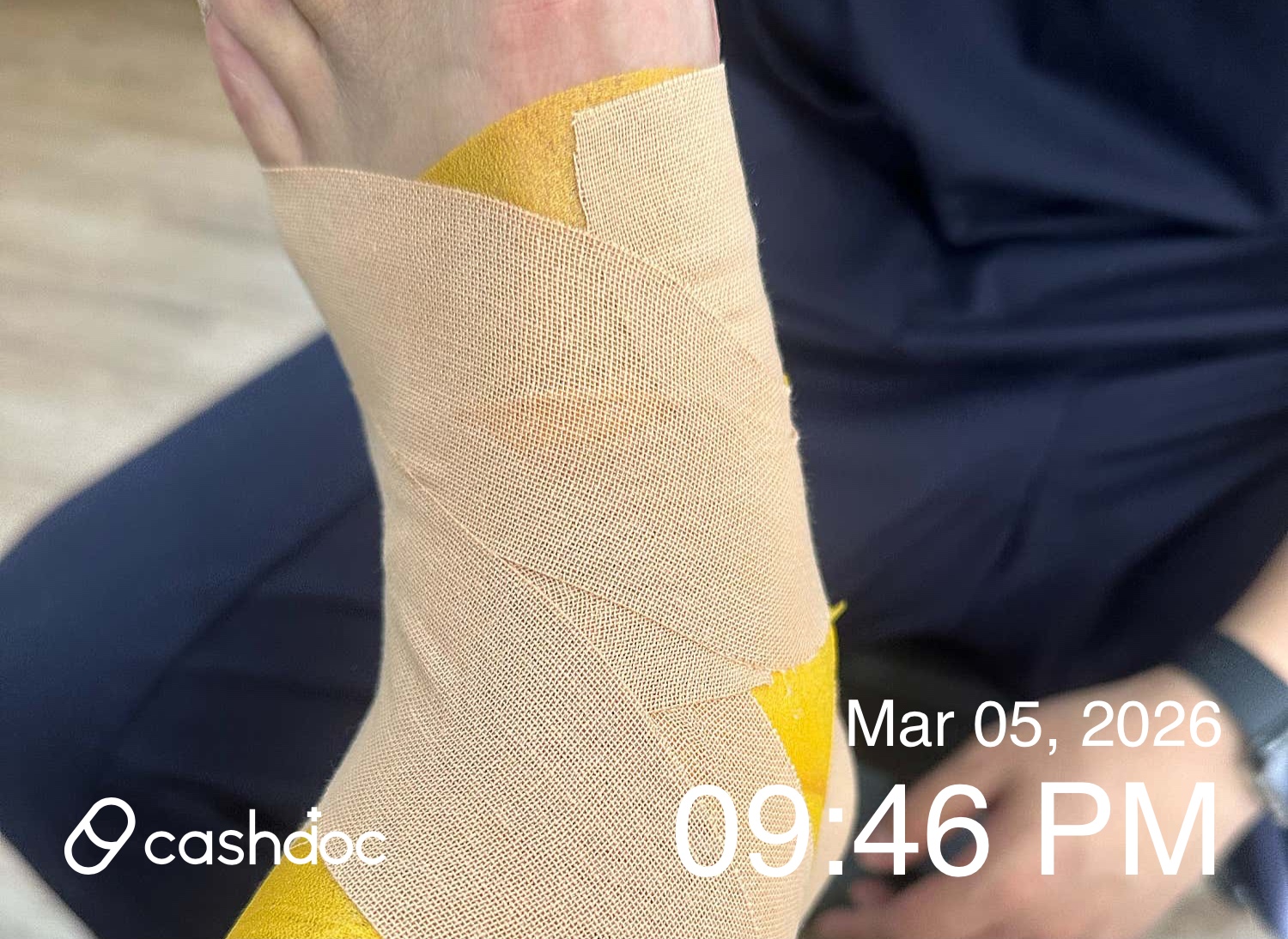 성남시 하나이비인후과의원에서 발목 신속 치료 후기