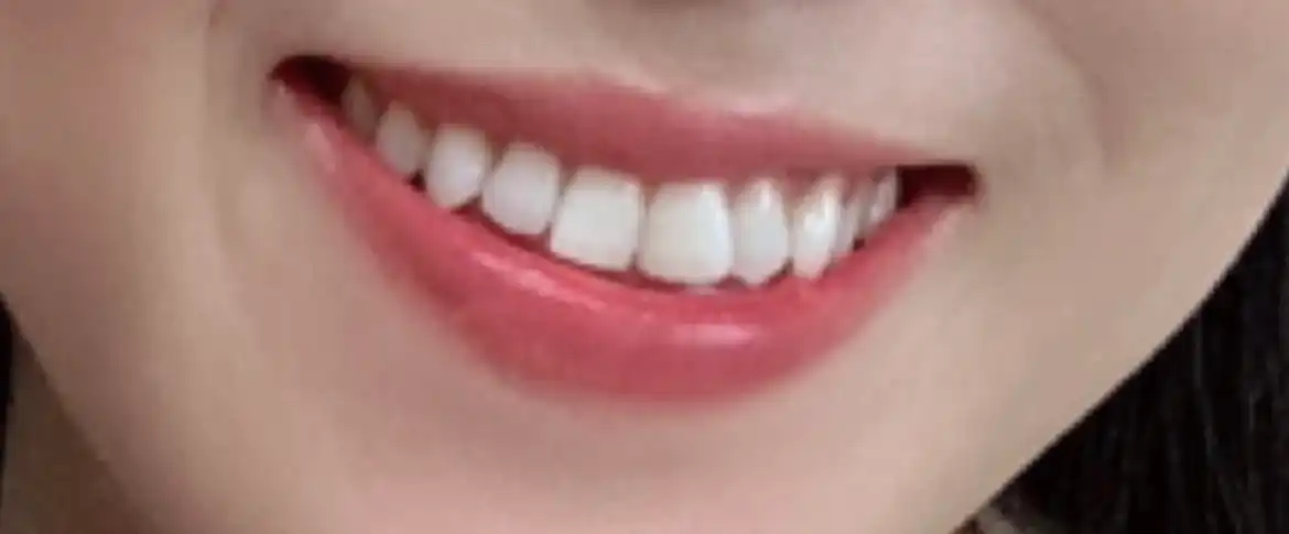 전
