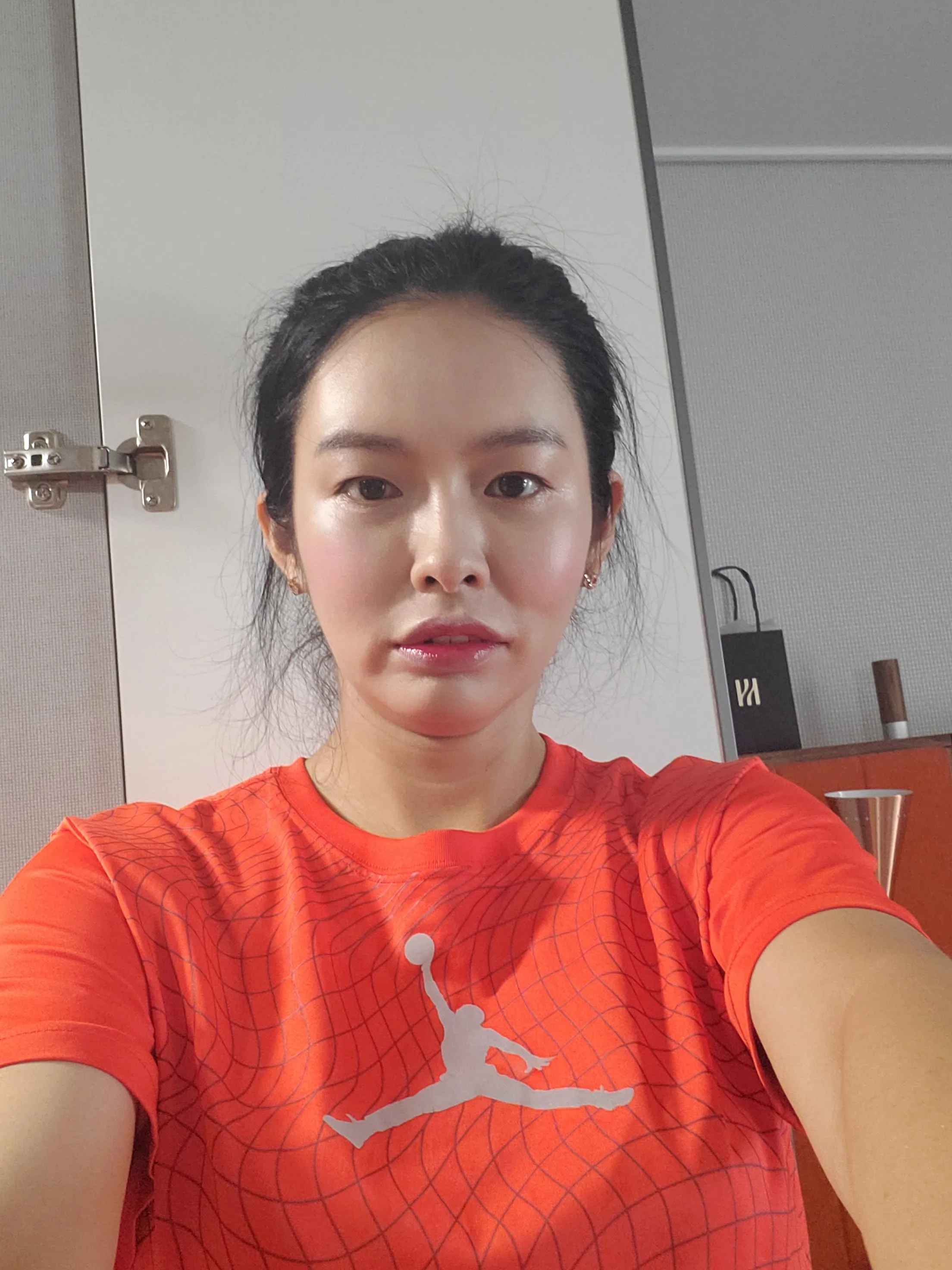 시술 전 — 미케이 주름&사각턱 보톡스