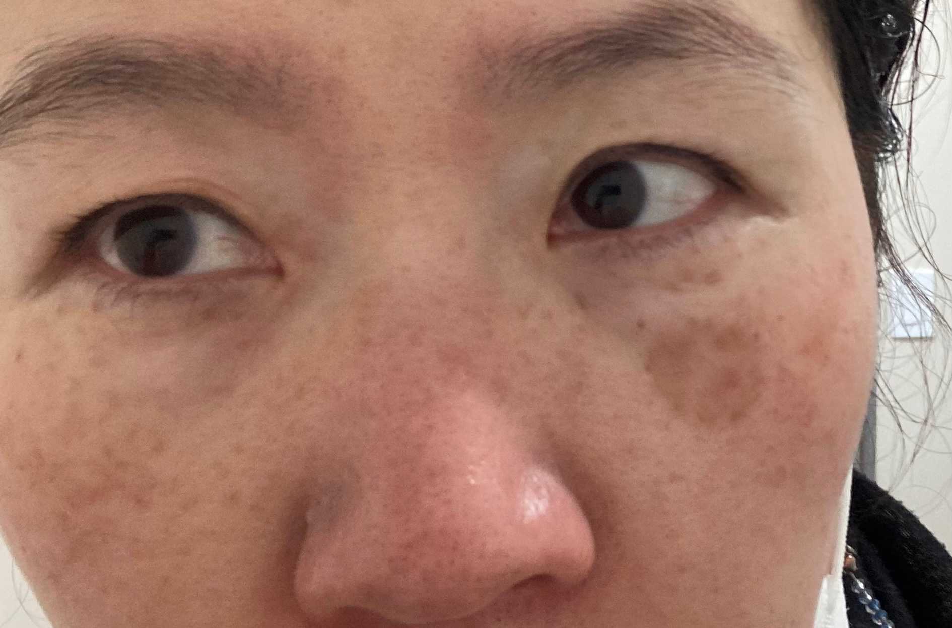 前