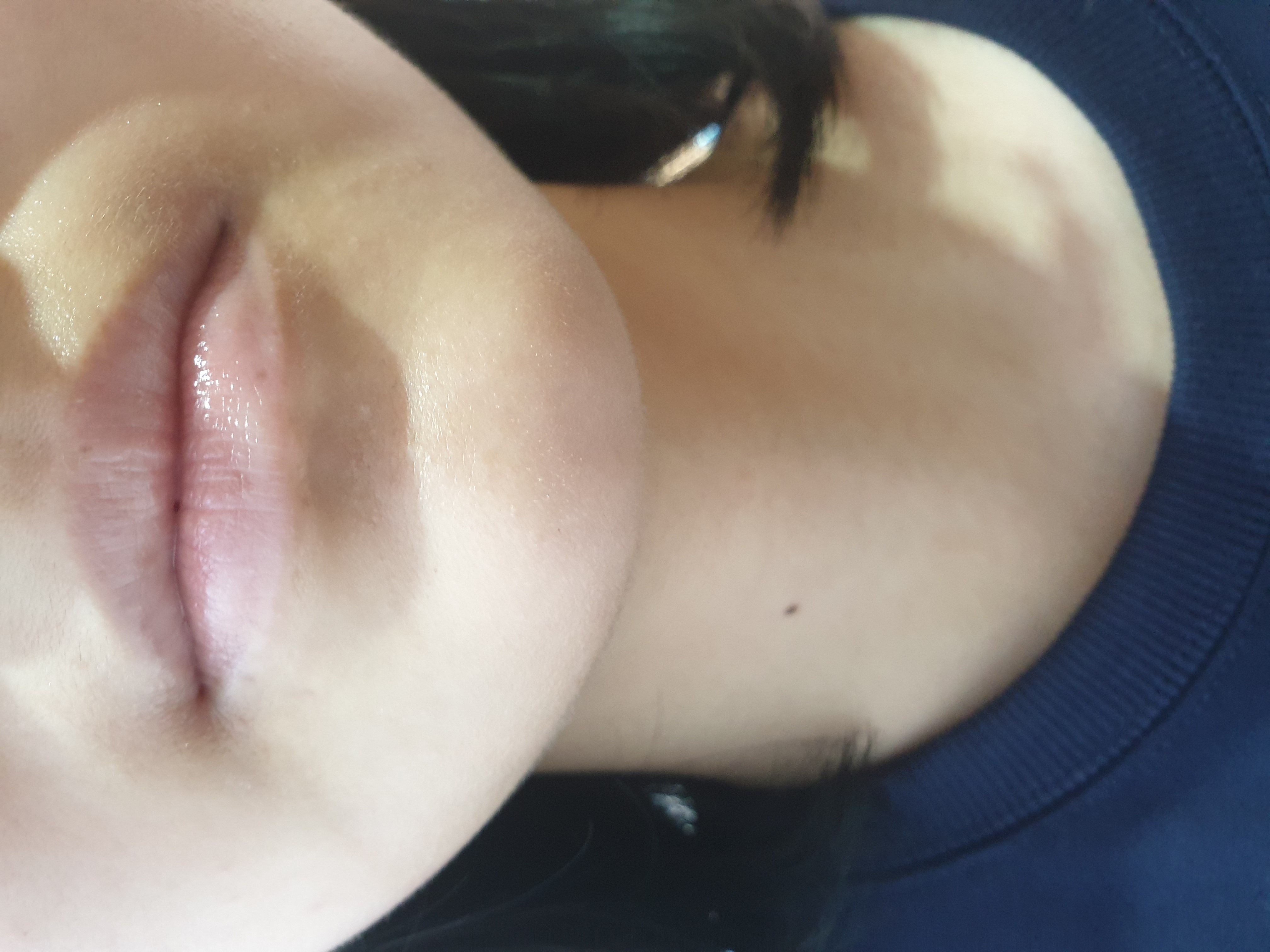 After