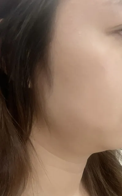 시술 전 사진