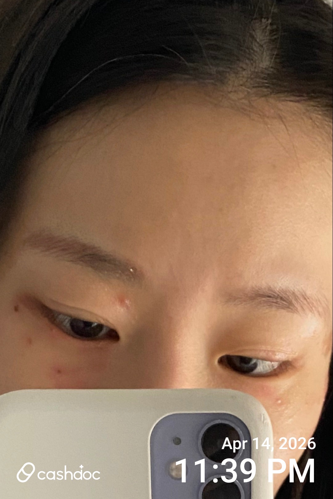 오산맑은피부과의원에서 피부 트러블 해결 경험!