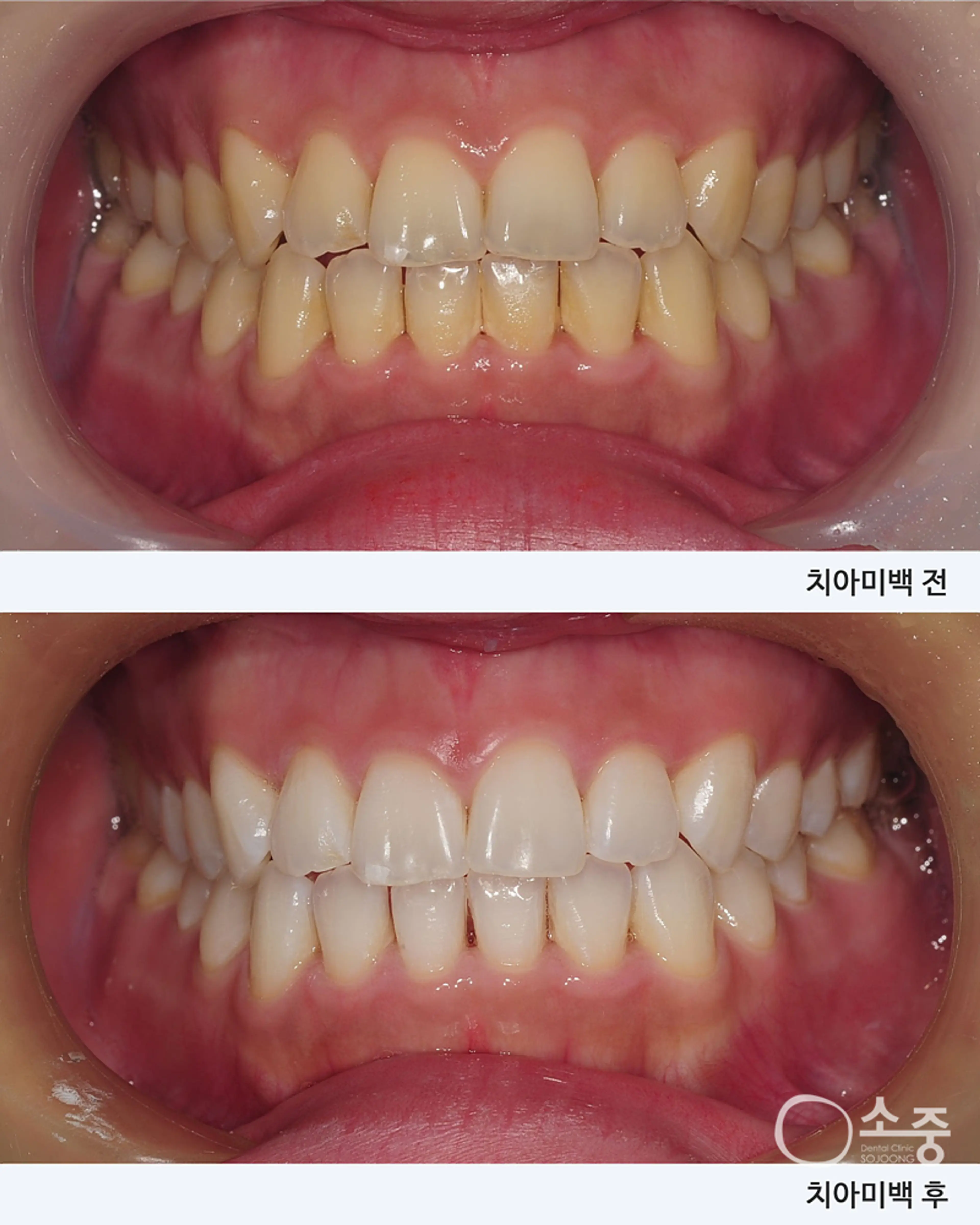 소중치과의원 - 10
