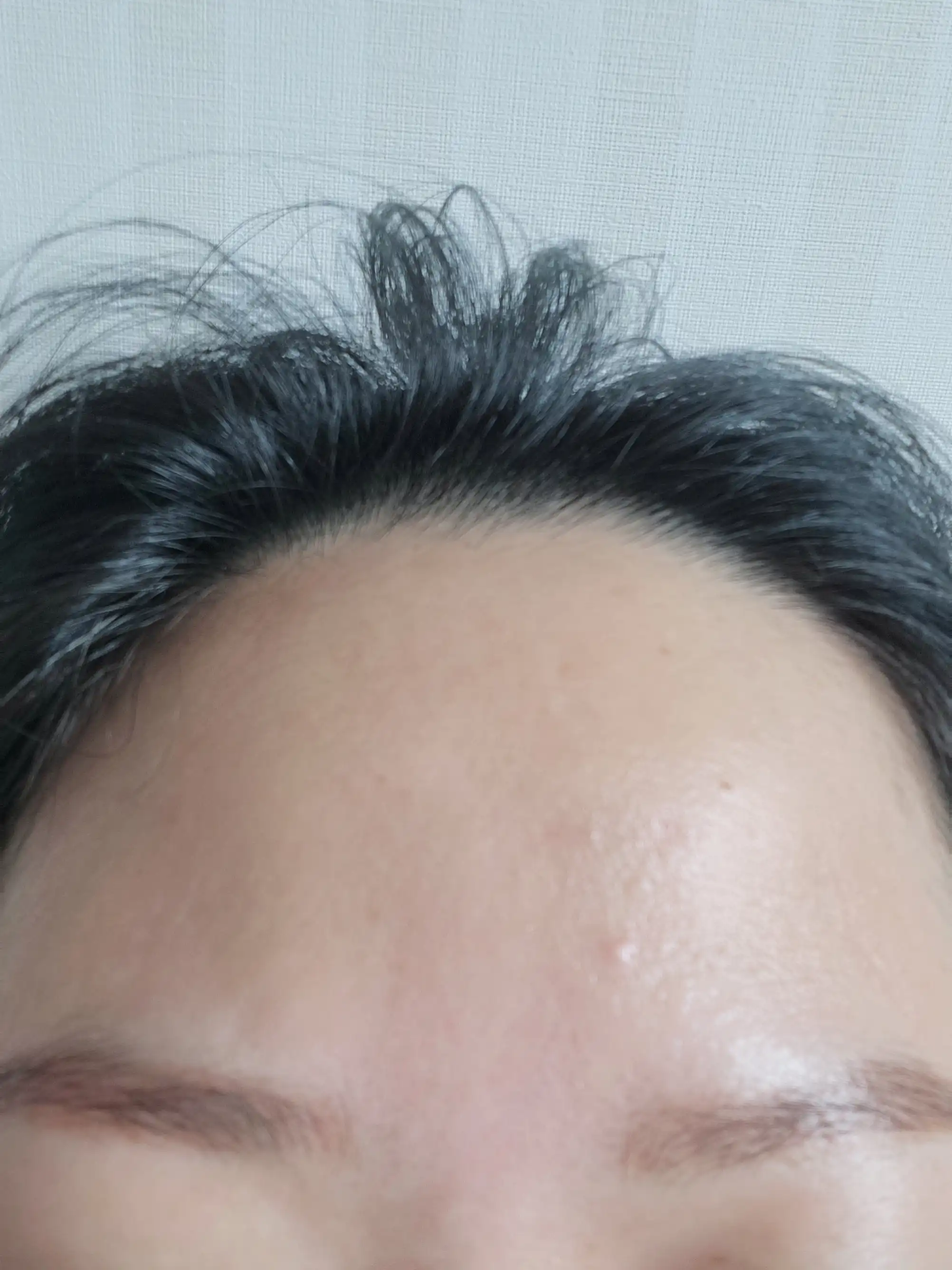 후