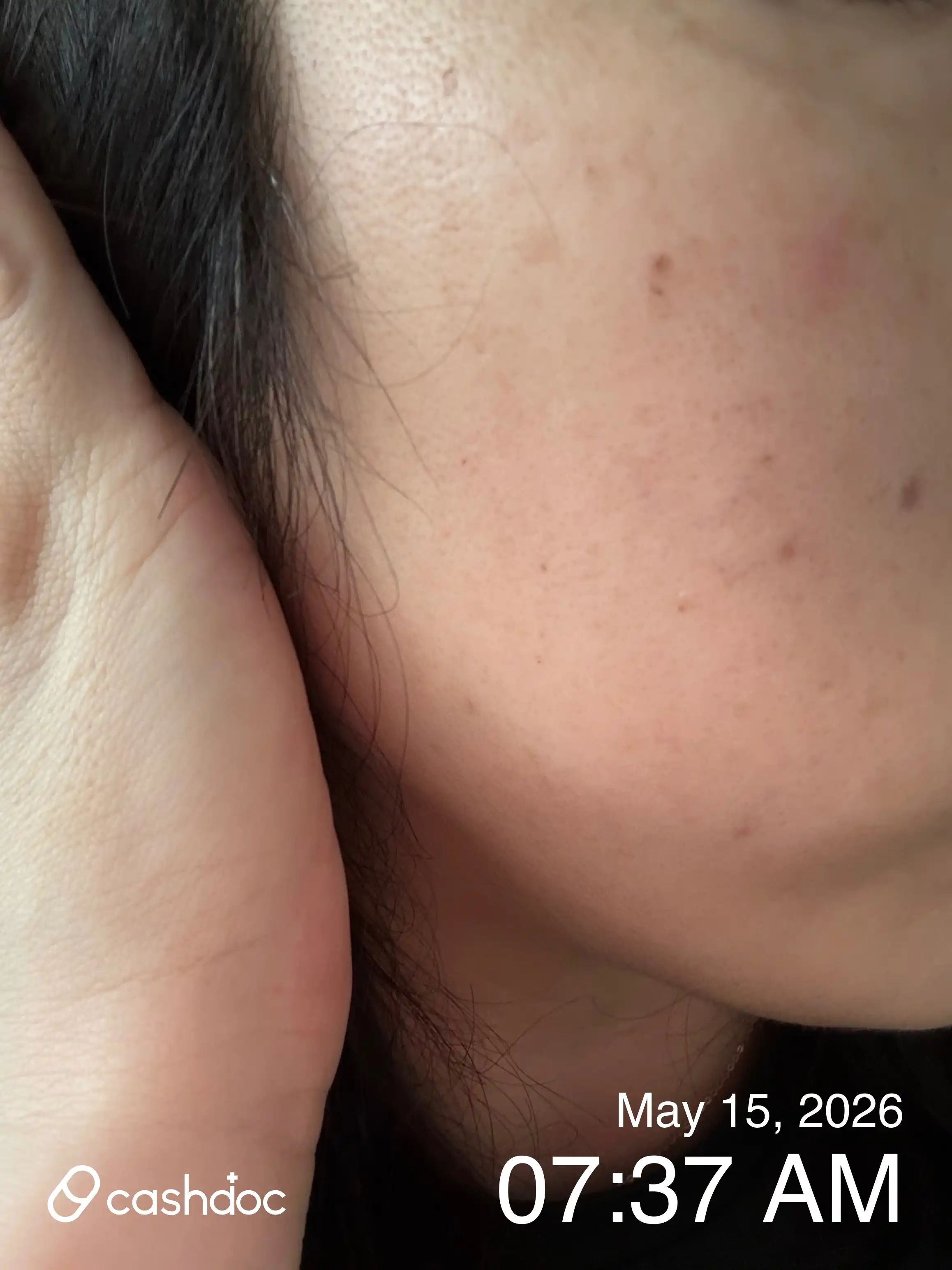 Review photo