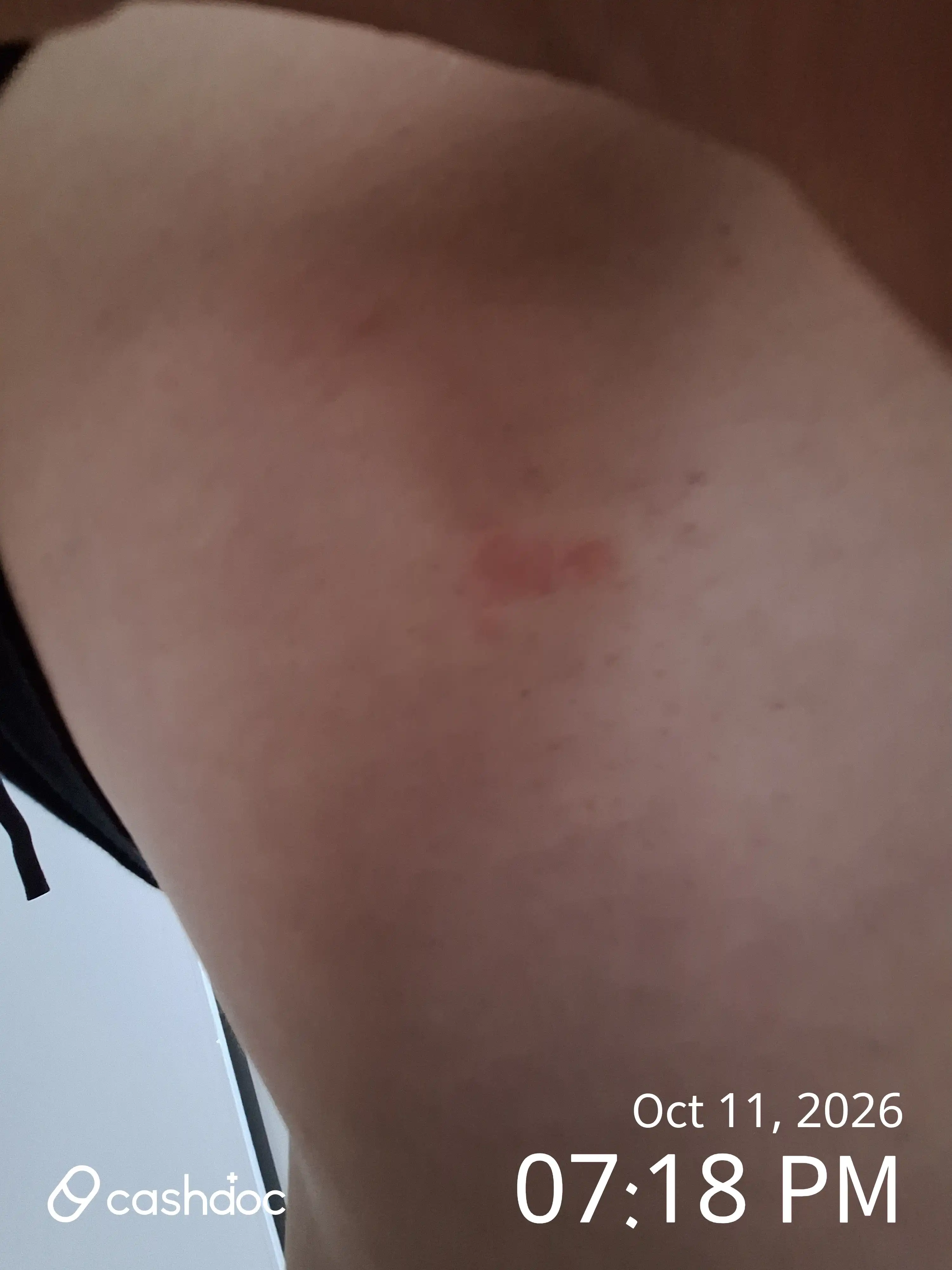 评价照片