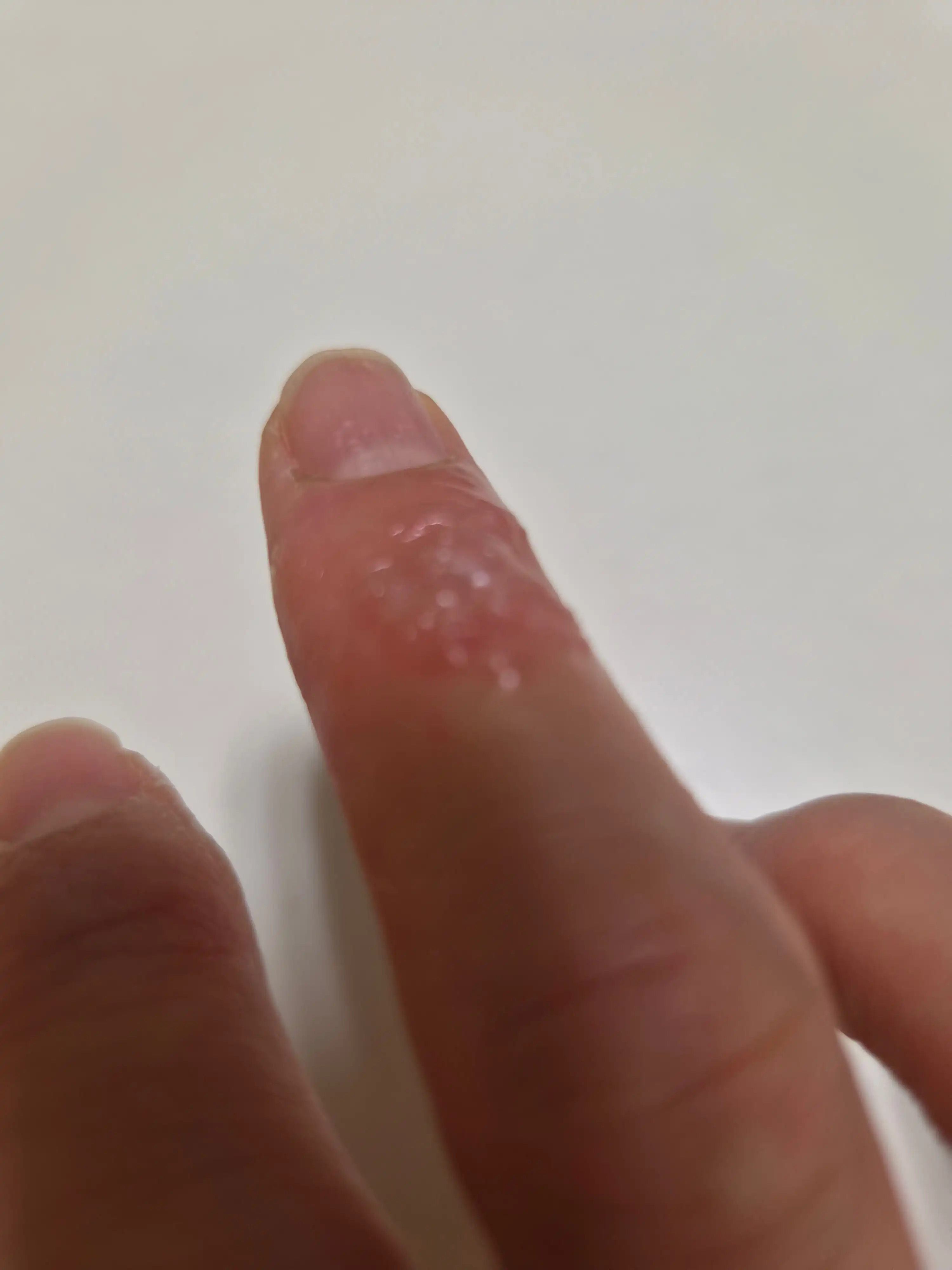 评价照片