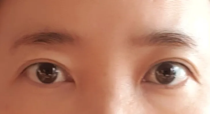시술 전 — 미케이 반영구_눈썹, 입술, 아이라인