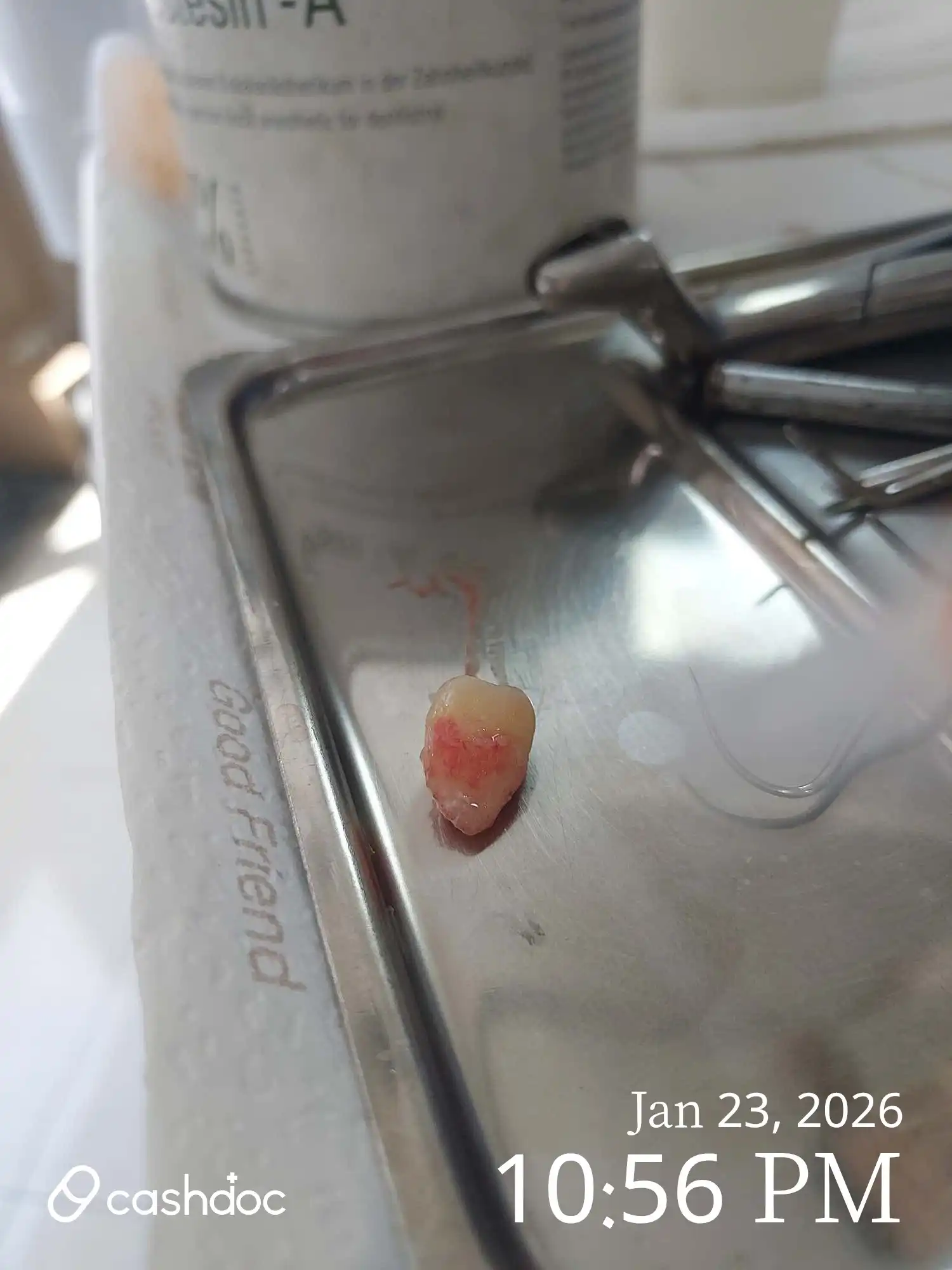 评价照片