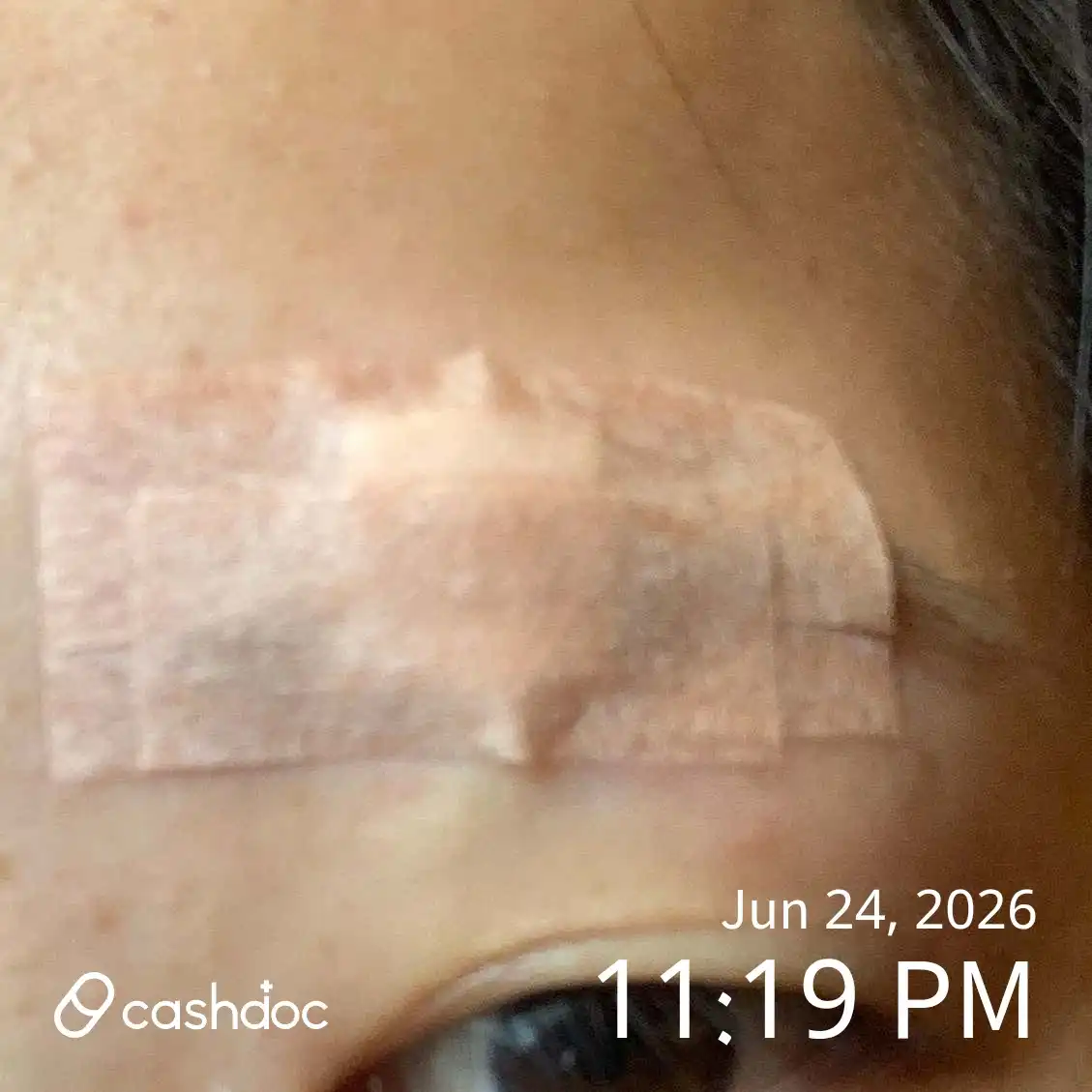 Review photo