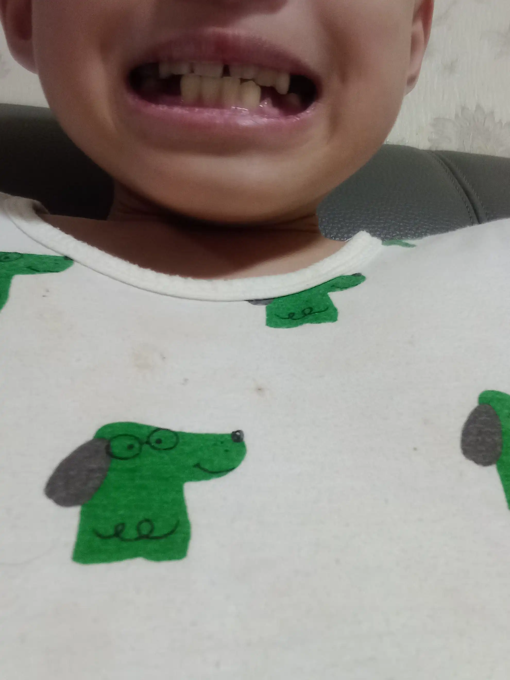 Review photo