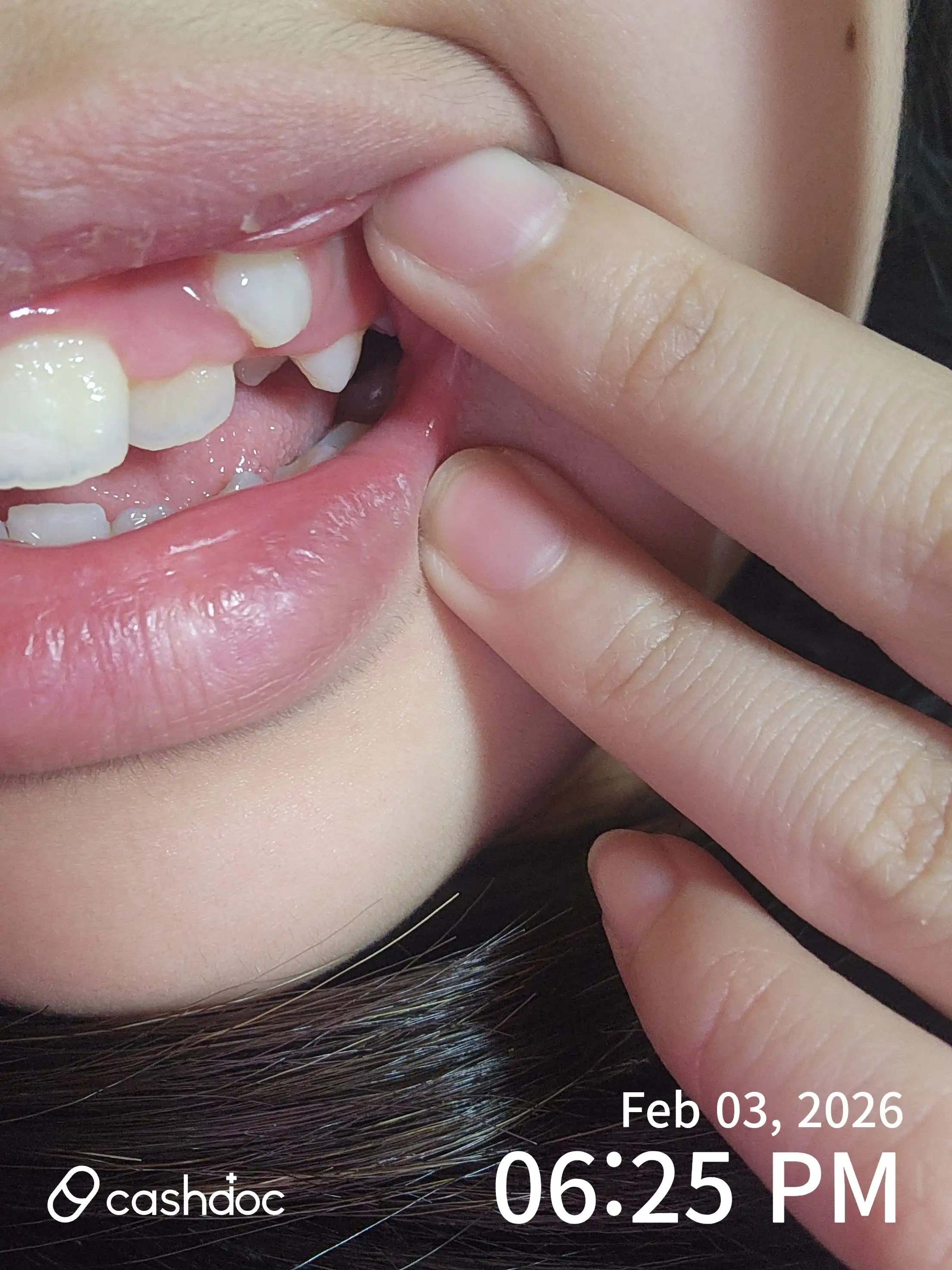 Review photo
