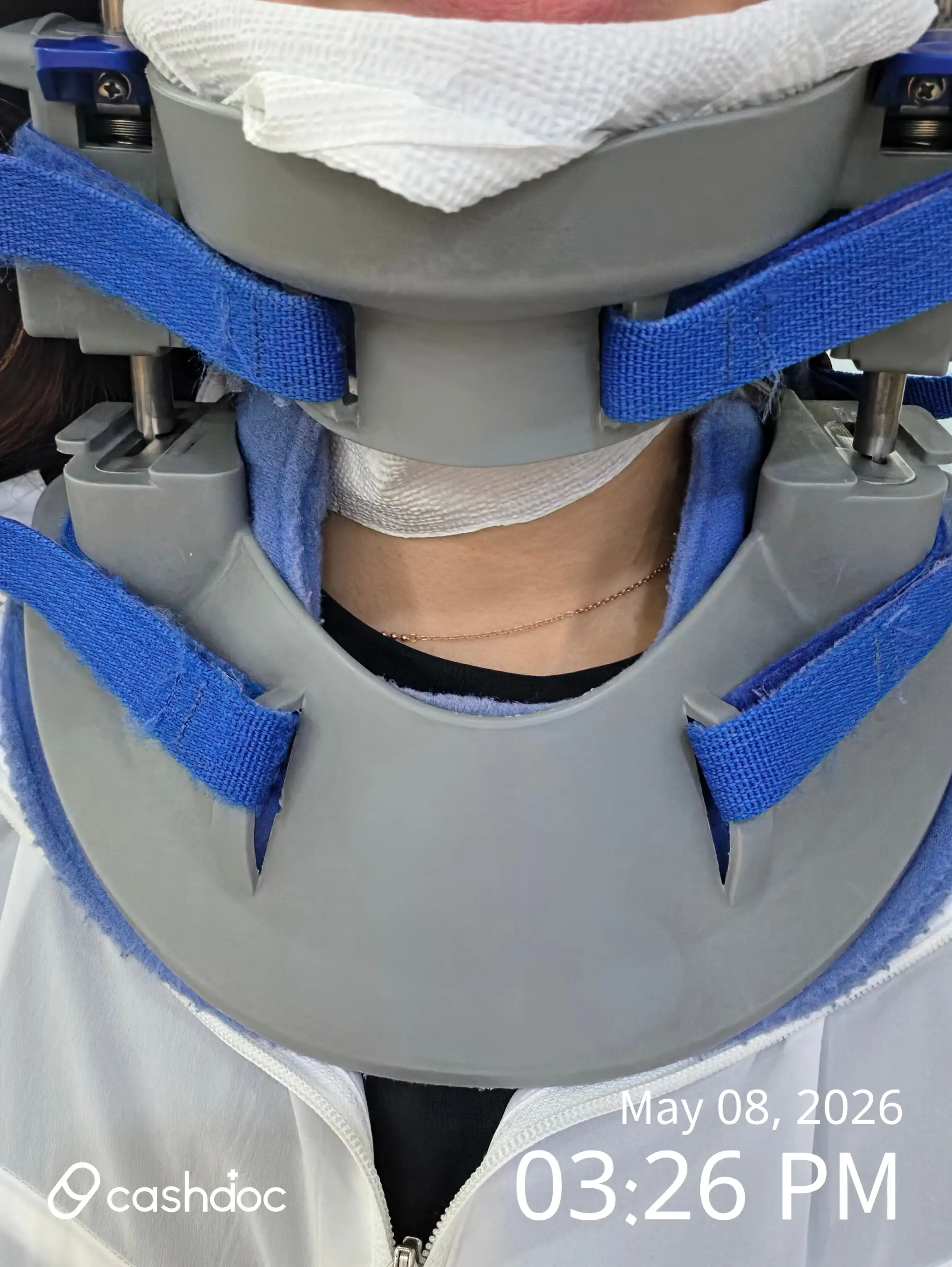 Review photo