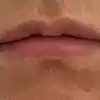 前