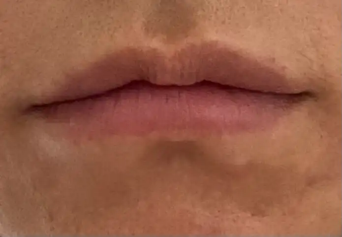 전