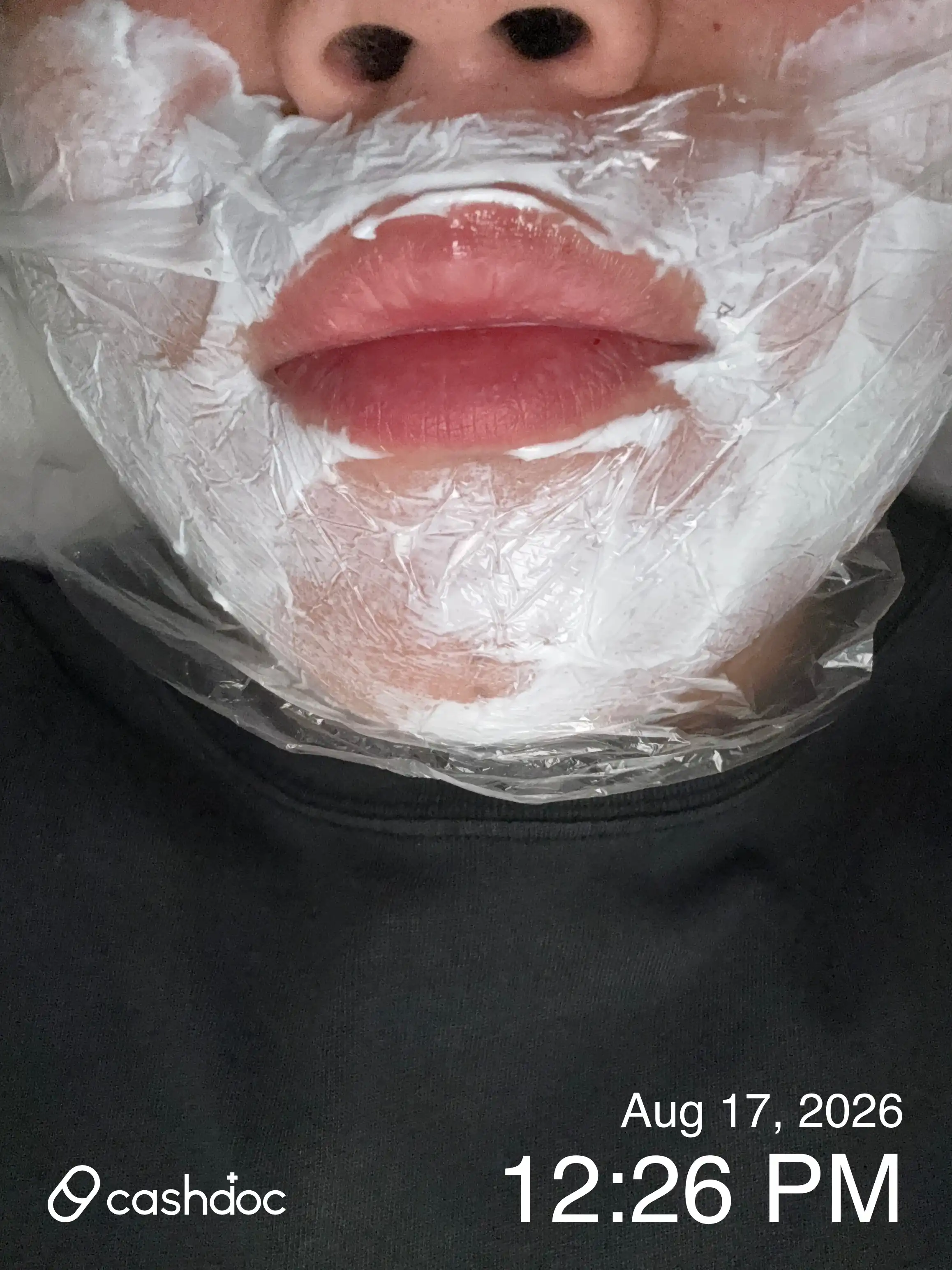 Review photo