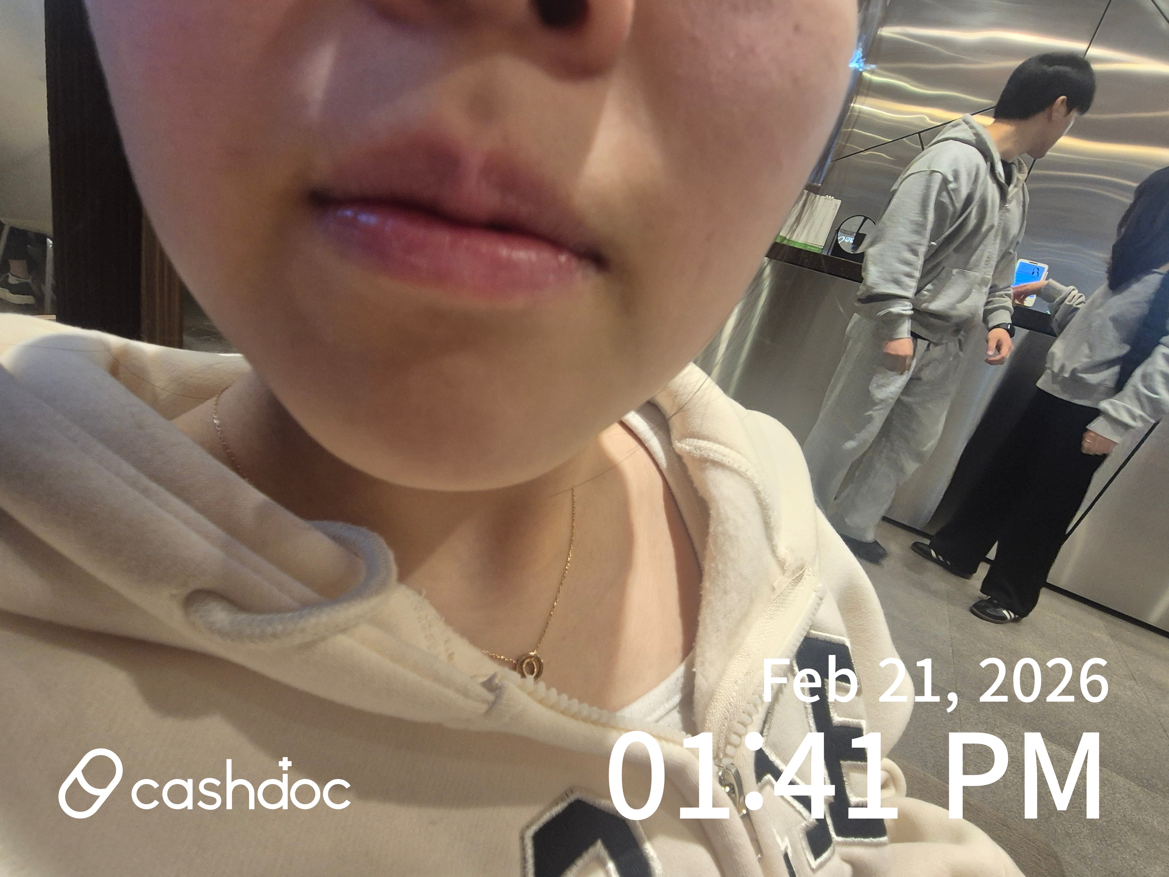 중구 리엘르의원, 보톡스 가성비 최고에요!