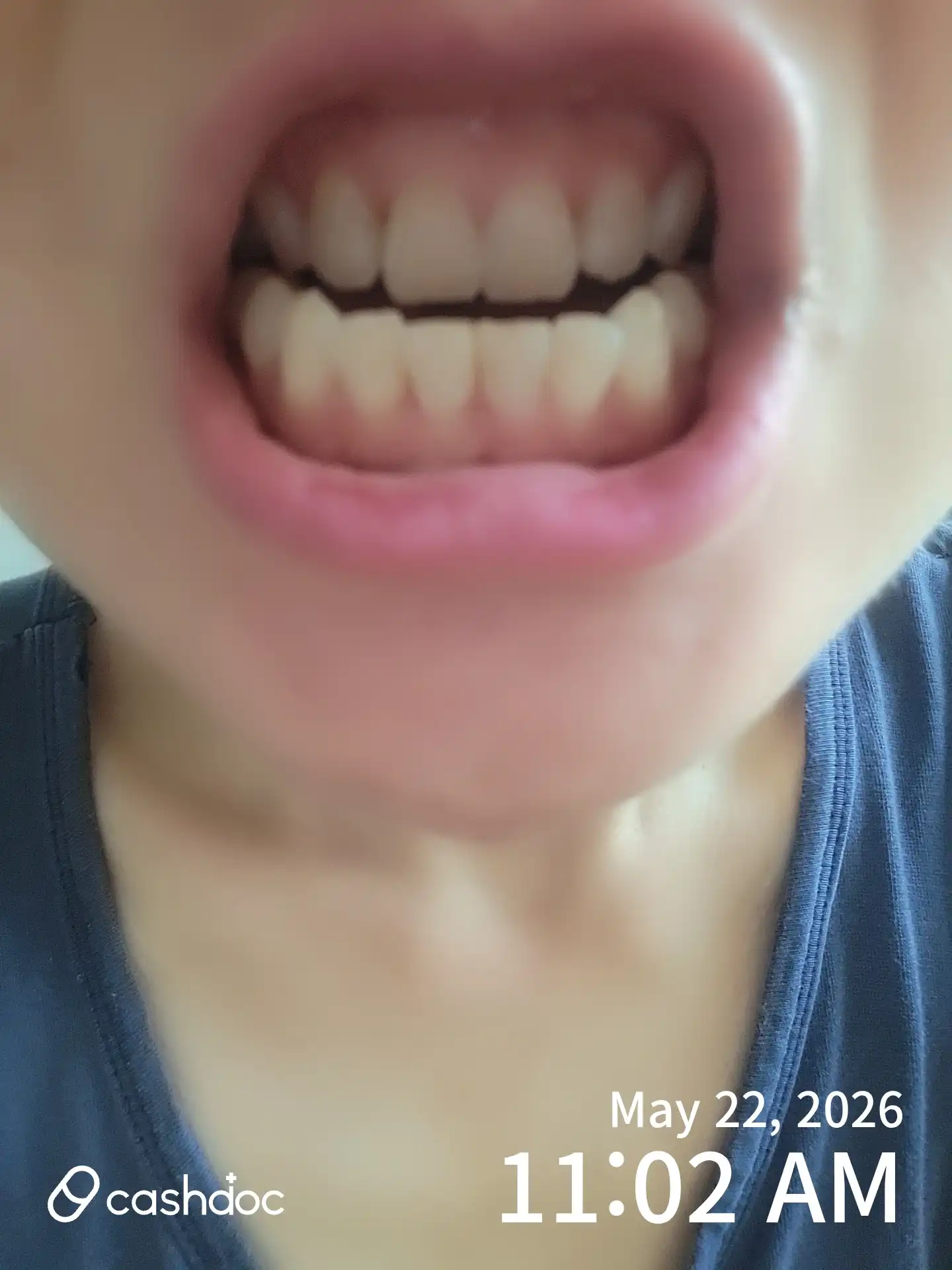 Review photo