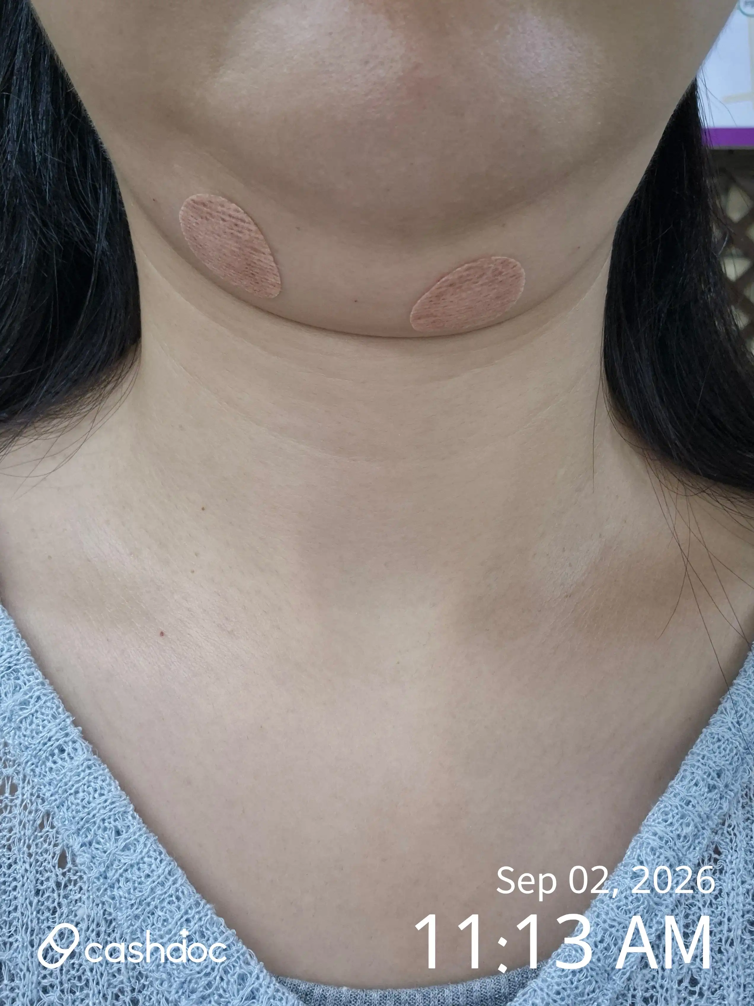 Review photo
